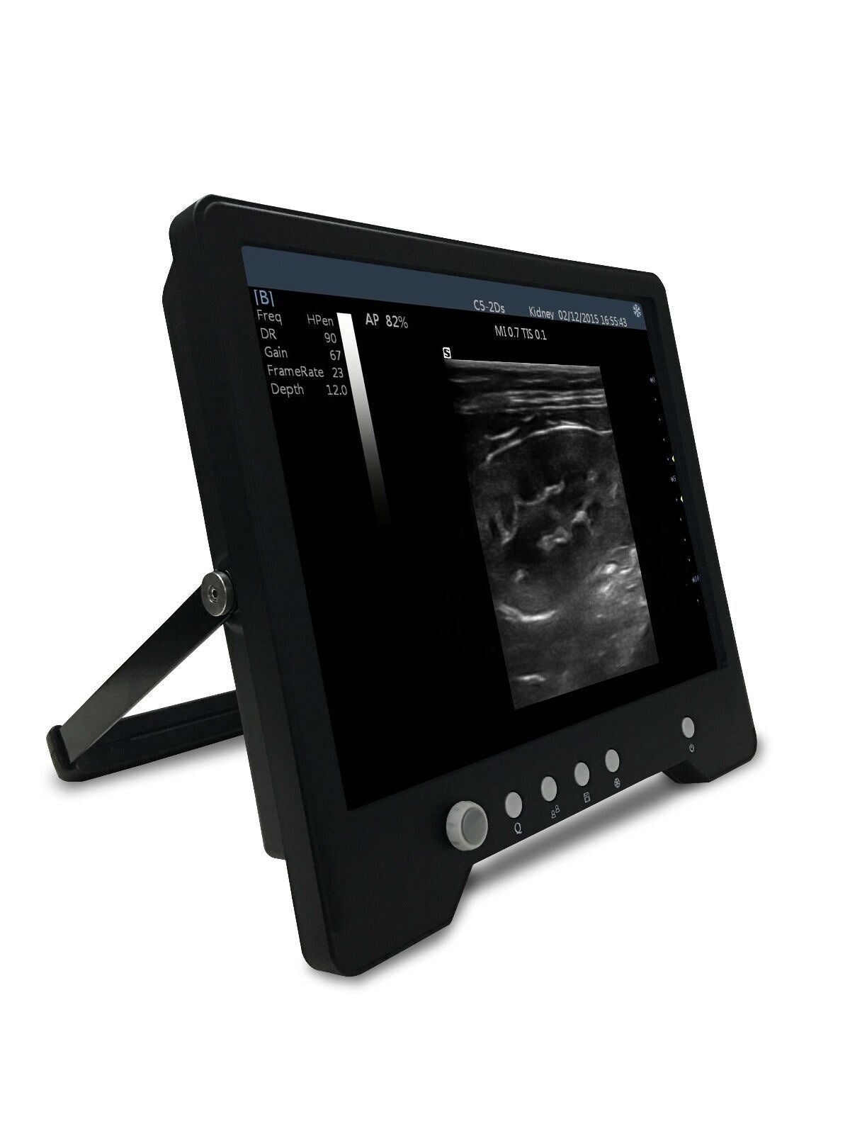 Veterinary Touch Screen Ultrasound with Rectal Probe for Large Animals, KeeboMed DIAGNOSTIC ULTRASOUND MACHINES FOR SALE