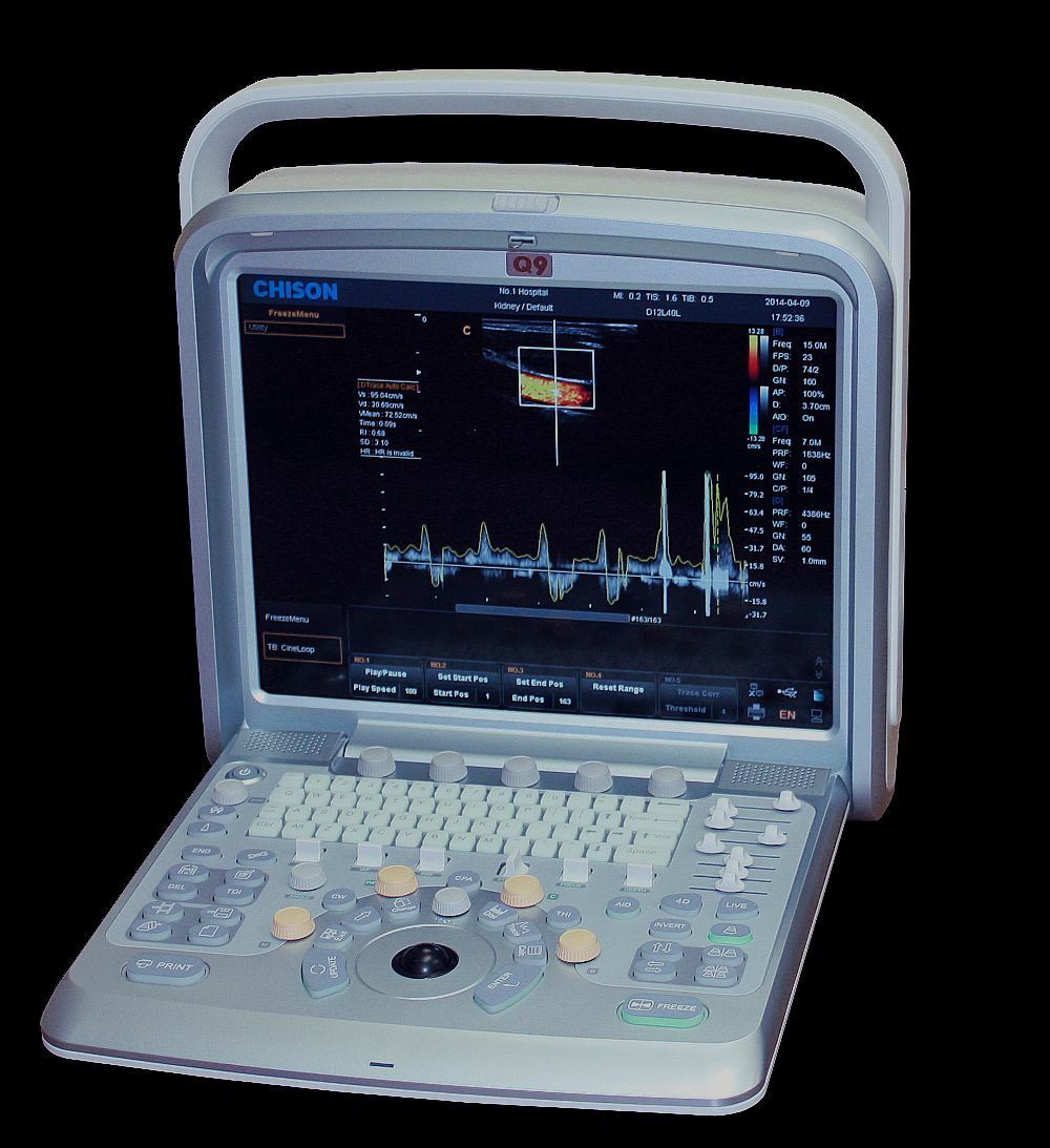 Chison Ebit 30 Color Doppler Ultrasound Scanner with Linear Array Probe 7-18MHz DIAGNOSTIC ULTRASOUND MACHINES FOR SALE