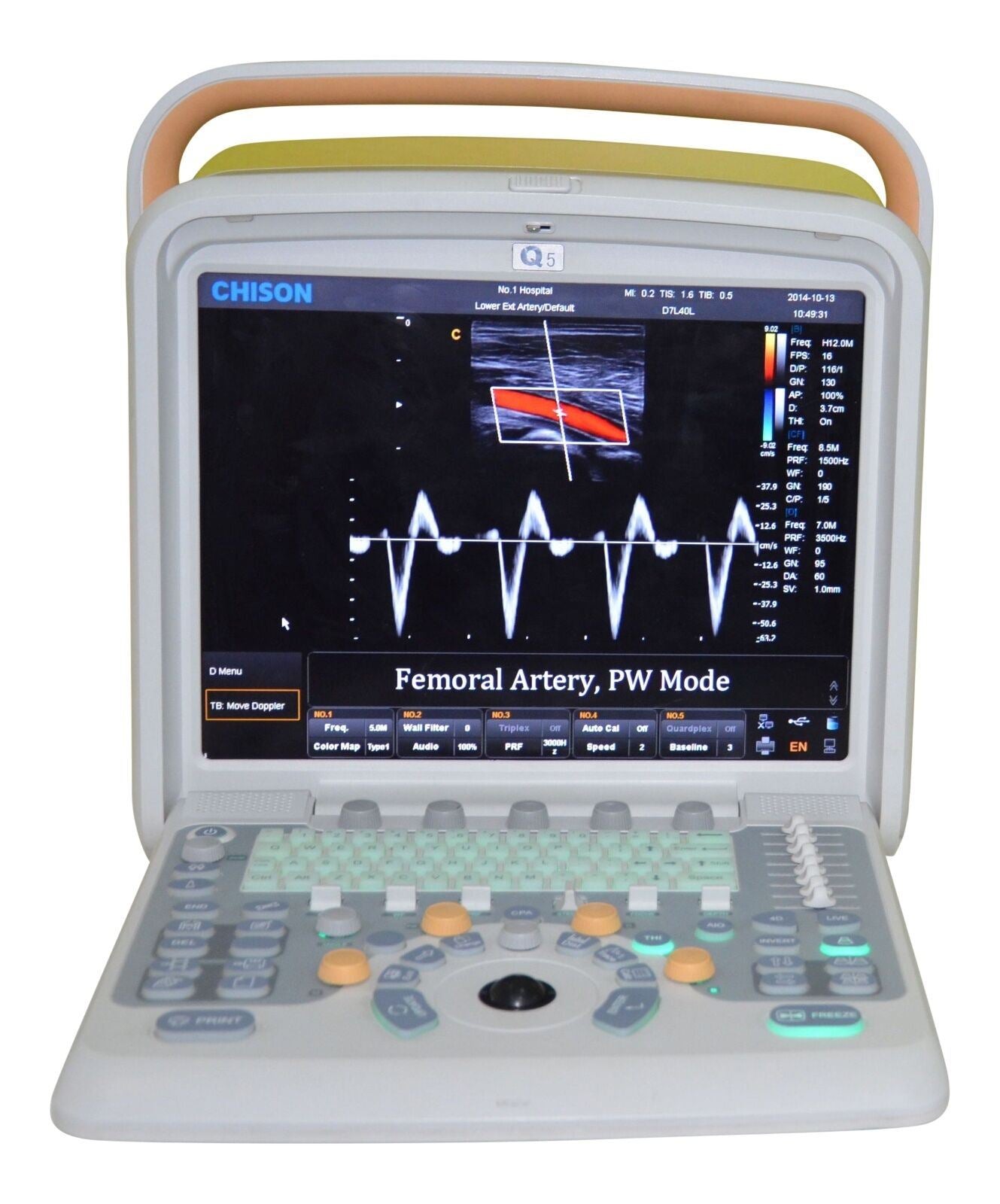 Veterinary Ultrasound Scanner with one  Probes - Color Doppler Chison Q5Vet DIAGNOSTIC ULTRASOUND MACHINES FOR SALE