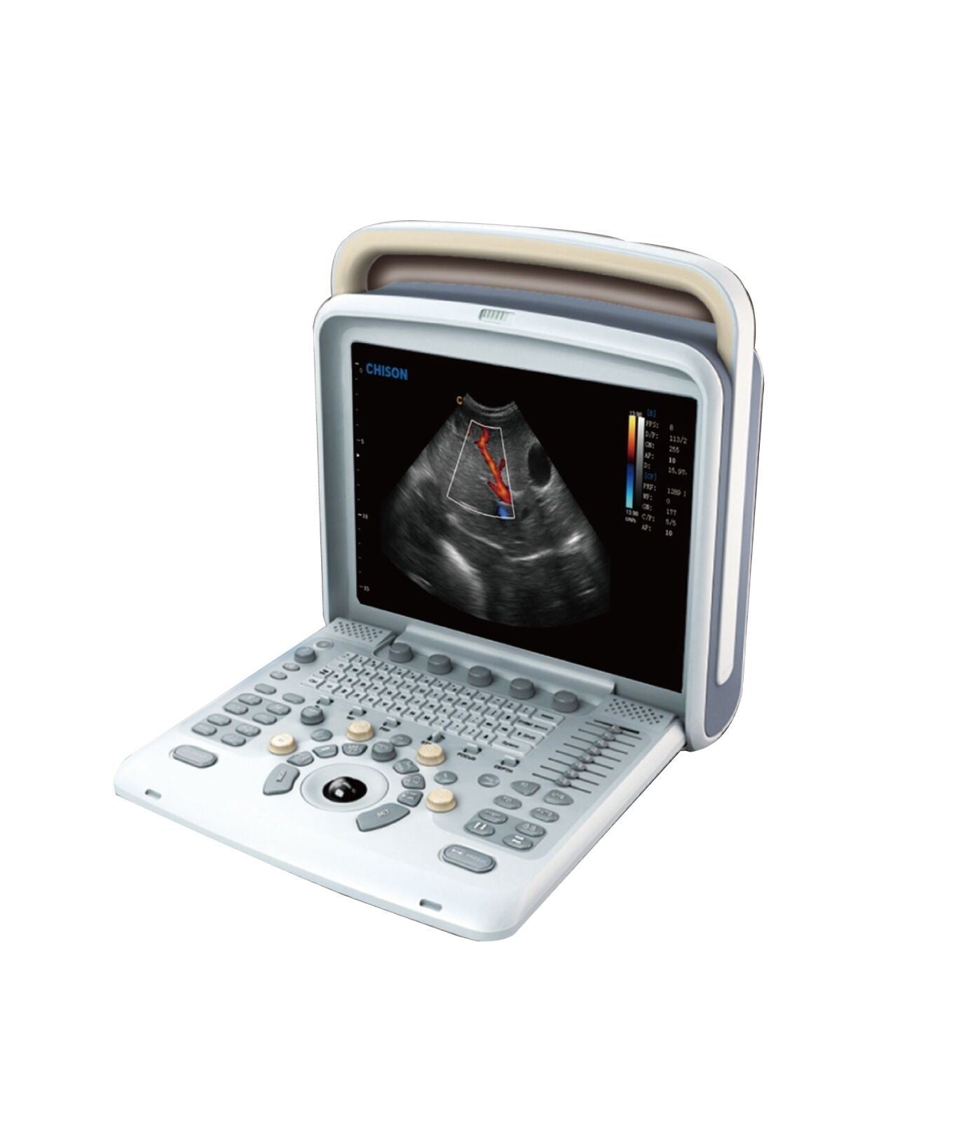 Veterinary Ultrasound Scanner with one  Probes - Color Doppler Chison Q5Vet DIAGNOSTIC ULTRASOUND MACHINES FOR SALE