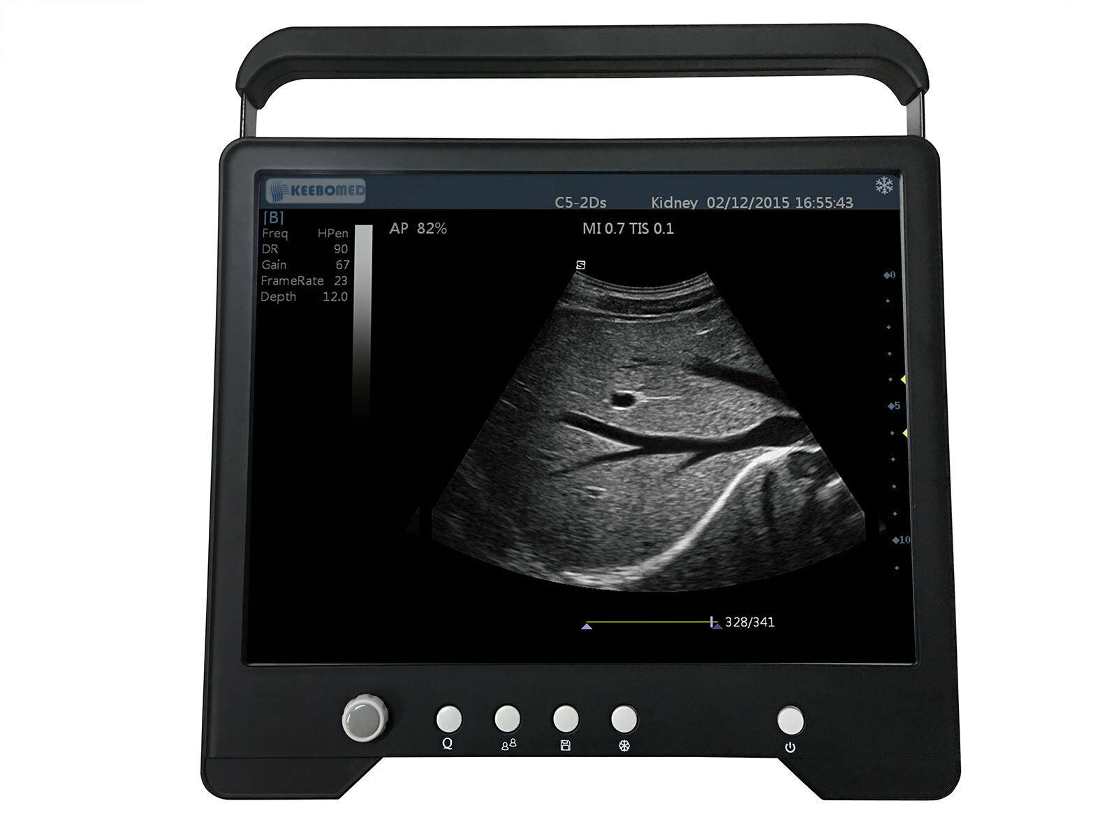 Veterinary Large & Small Animal Touch Screen Ultrasound w/ Two Probes | KeeboMed DIAGNOSTIC ULTRASOUND MACHINES FOR SALE