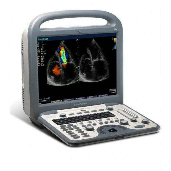 SonoScape S8 with L743 Linear array  Probe Included - new DIAGNOSTIC ULTRASOUND MACHINES FOR SALE