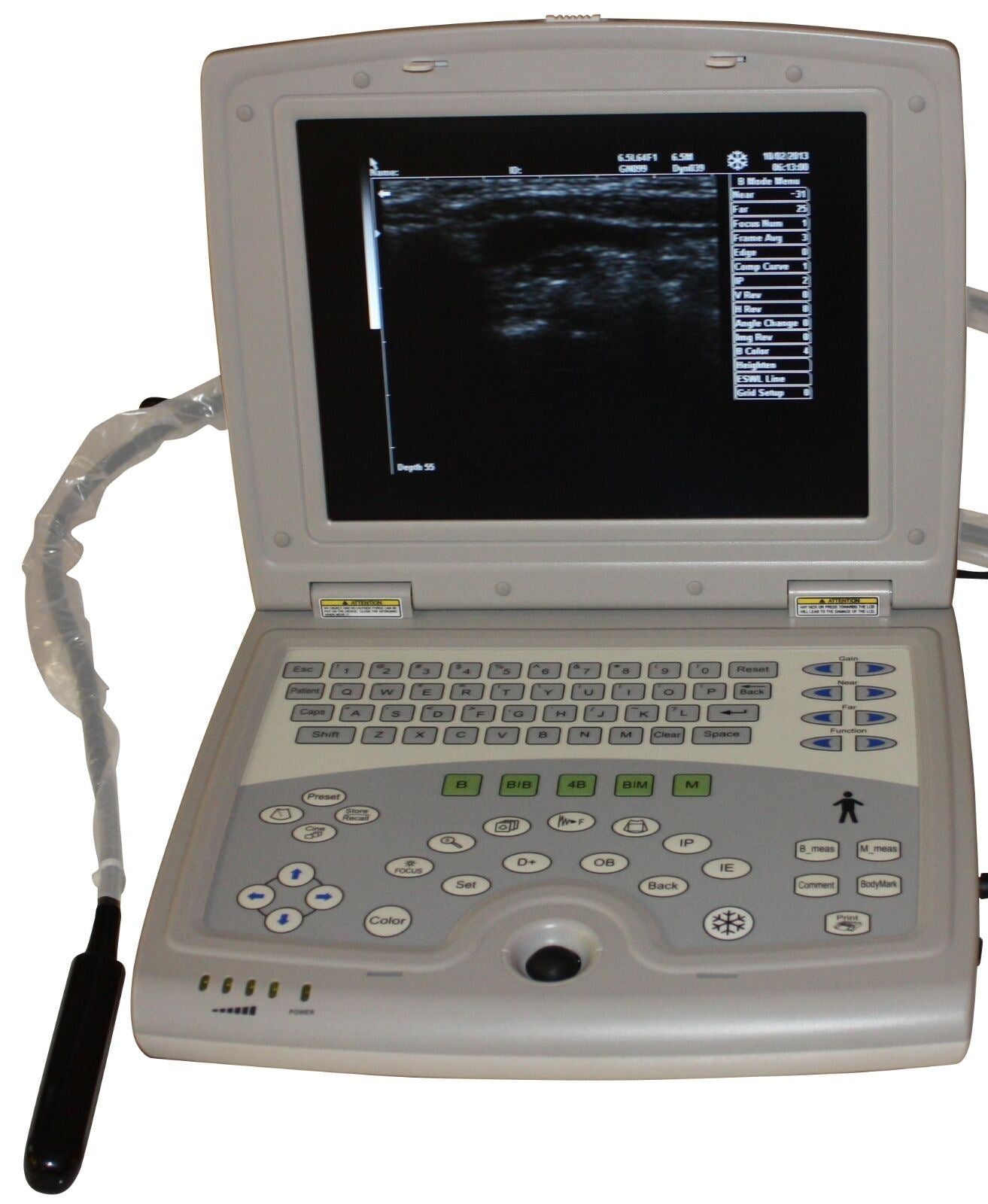 keebomed KX5000KV Veterinary Ultrasound with Rectal Probe DIAGNOSTIC ULTRASOUND MACHINES FOR SALE