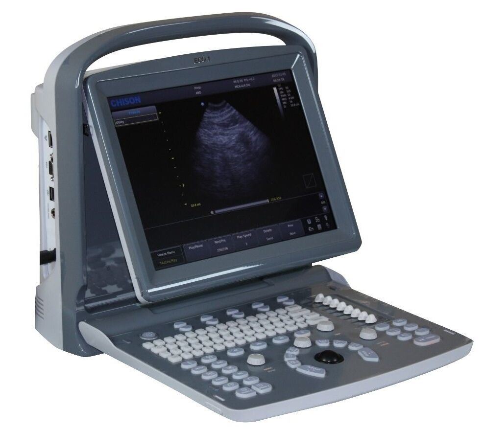 Chison ECO1 Portable LED Ultrasons Scanner, Qualité Et Abordable DIAGNOSTIC ULTRASOUND MACHINES FOR SALE