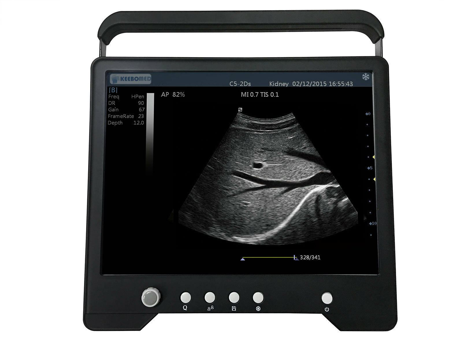 Reptiles Ou Équin Vétérinaire 15 " Ecran Tactile Ultrasons Avec Linéaire Array DIAGNOSTIC ULTRASOUND MACHINES FOR SALE