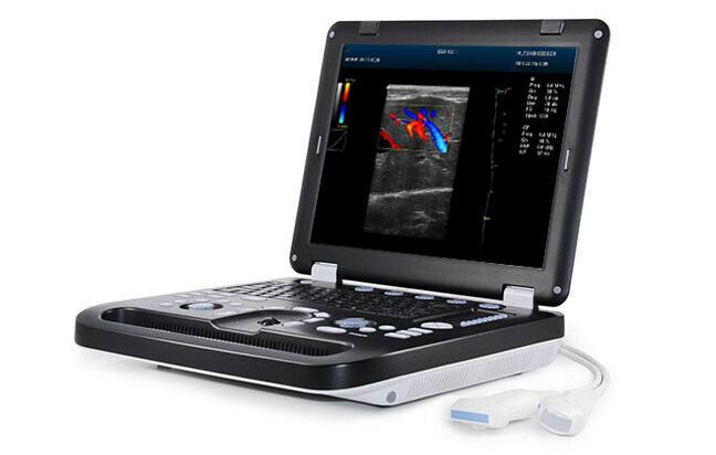 Newest- Color Portable Ultrasound & One Probe, DICOM, LED screen DIAGNOSTIC ULTRASOUND MACHINES FOR SALE