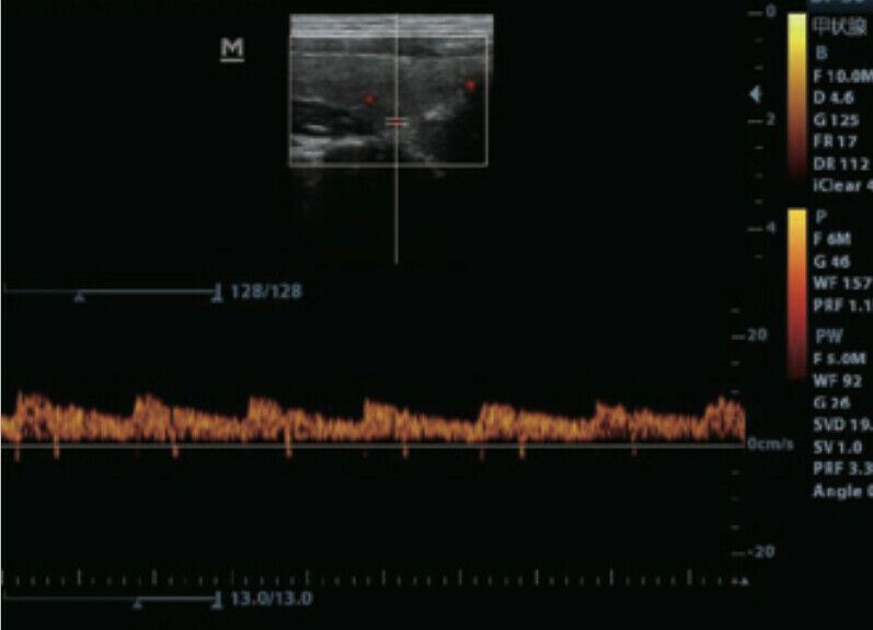 Color Doppler Ultrasound & One linear Array Probe DIAGNOSTIC ULTRASOUND MACHINES FOR SALE