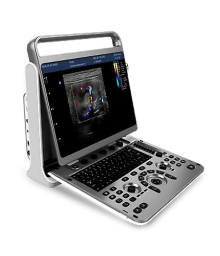 Chison eBit60Vet High End Color Doppler Veterinary Software Portable Ultrasound DIAGNOSTIC ULTRASOUND MACHINES FOR SALE