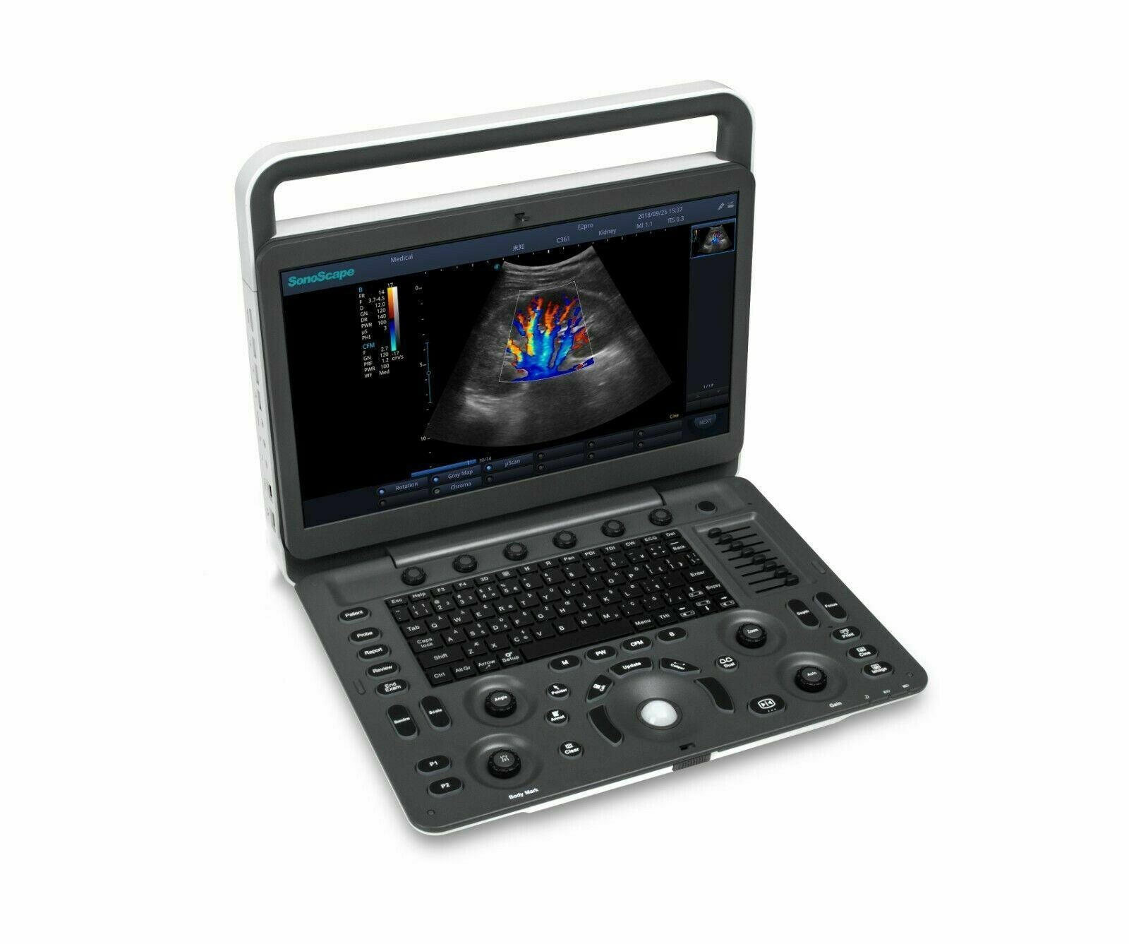 SonoScape E2 Color Doppler Vascular Ultrasound with Linear Array Probe L741 DIAGNOSTIC ULTRASOUND MACHINES FOR SALE