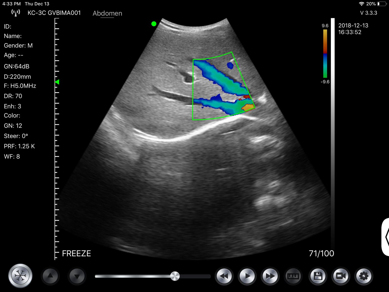 Wireless Fetal Doppler Convex Probe Veterinary Ultrasound for iPad, iPhone App DIAGNOSTIC ULTRASOUND MACHINES FOR SALE