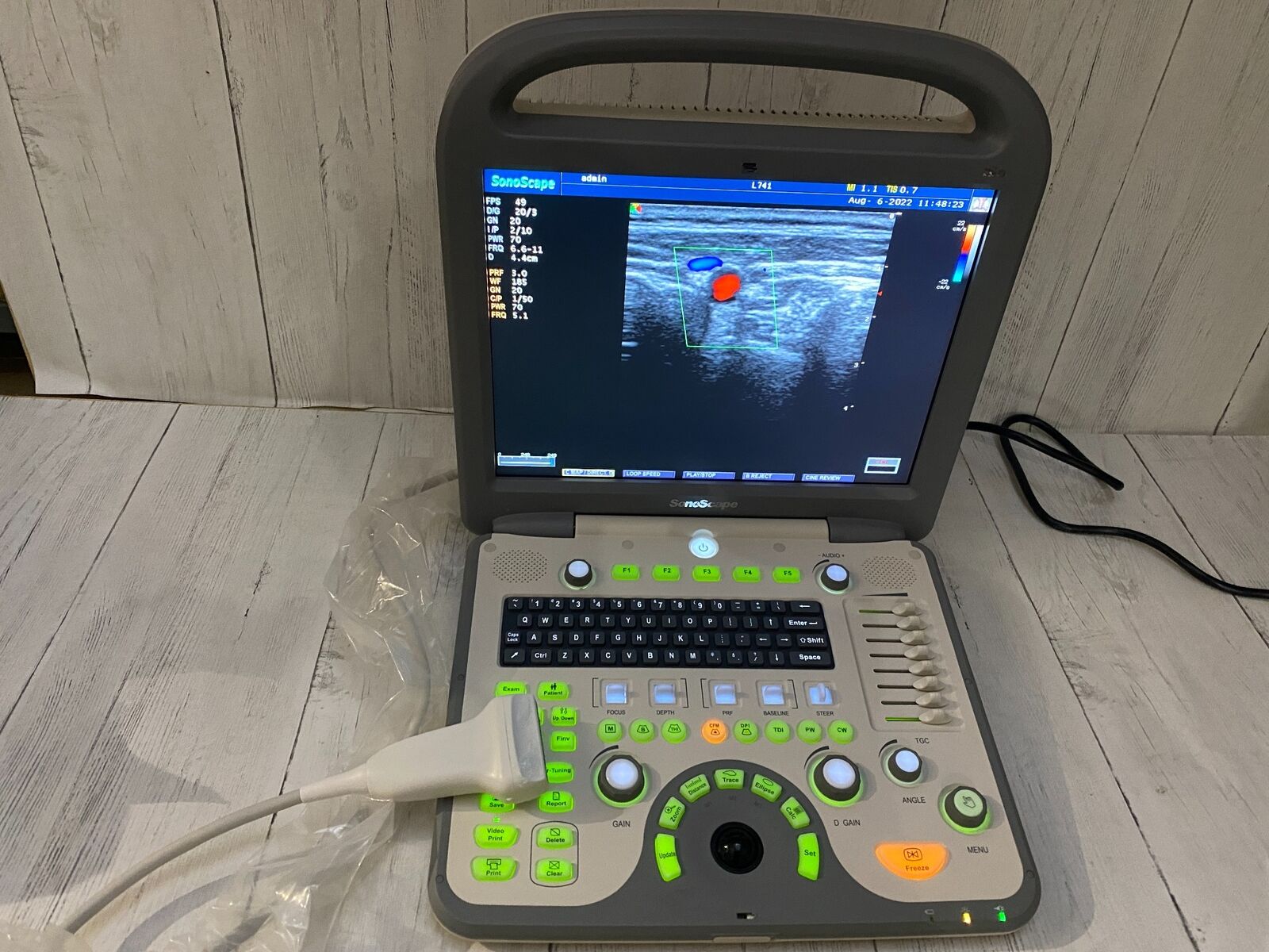 SonoScape S8 with linear array probe transducer L741 DIAGNOSTIC ULTRASOUND MACHINES FOR SALE