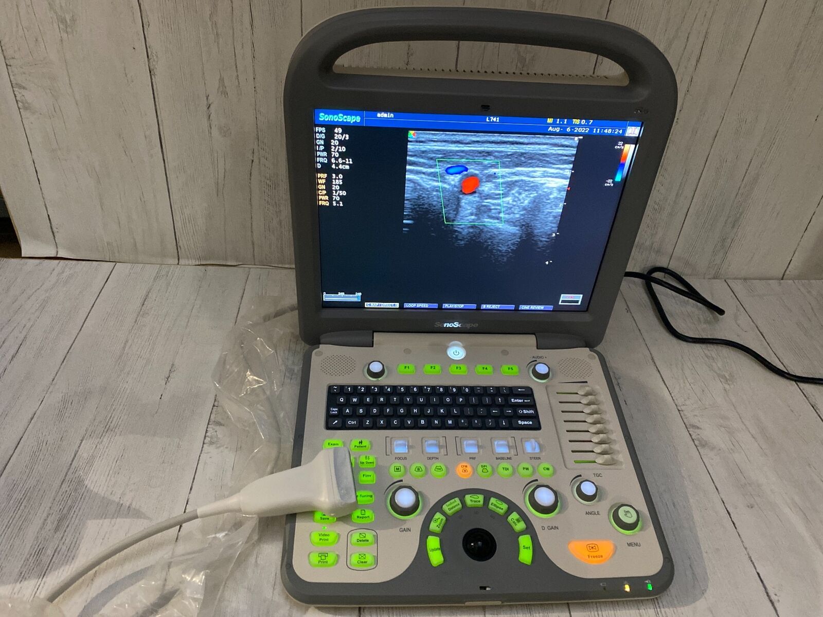 SonoScape S8 with linear array probe transducer L741 DIAGNOSTIC ULTRASOUND MACHINES FOR SALE