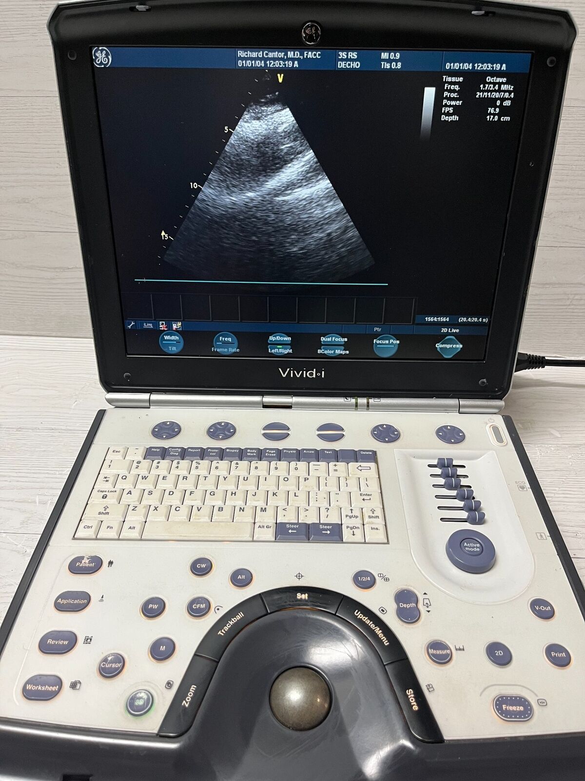 GE Vivid I Color Doppler Ultrasound Scanner, with 3s-RS cardiac & Linear L8-RS DIAGNOSTIC ULTRASOUND MACHINES FOR SALE