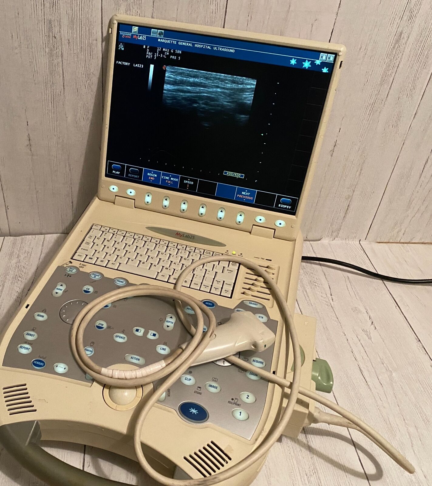 Esaote BioSound MyLab25  Portable Ultrasound with linear array probe  2005 DIAGNOSTIC ULTRASOUND MACHINES FOR SALE