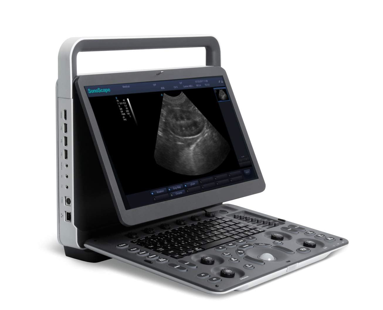 KeeboMed SonoScape E1V Veterinary Ultrasound with one Rectal Probe L741V DIAGNOSTIC ULTRASOUND MACHINES FOR SALE