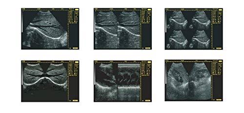 keebomed WED-3100V Veterinary Ultrasound for Large Animals DIAGNOSTIC ULTRASOUND MACHINES FOR SALE