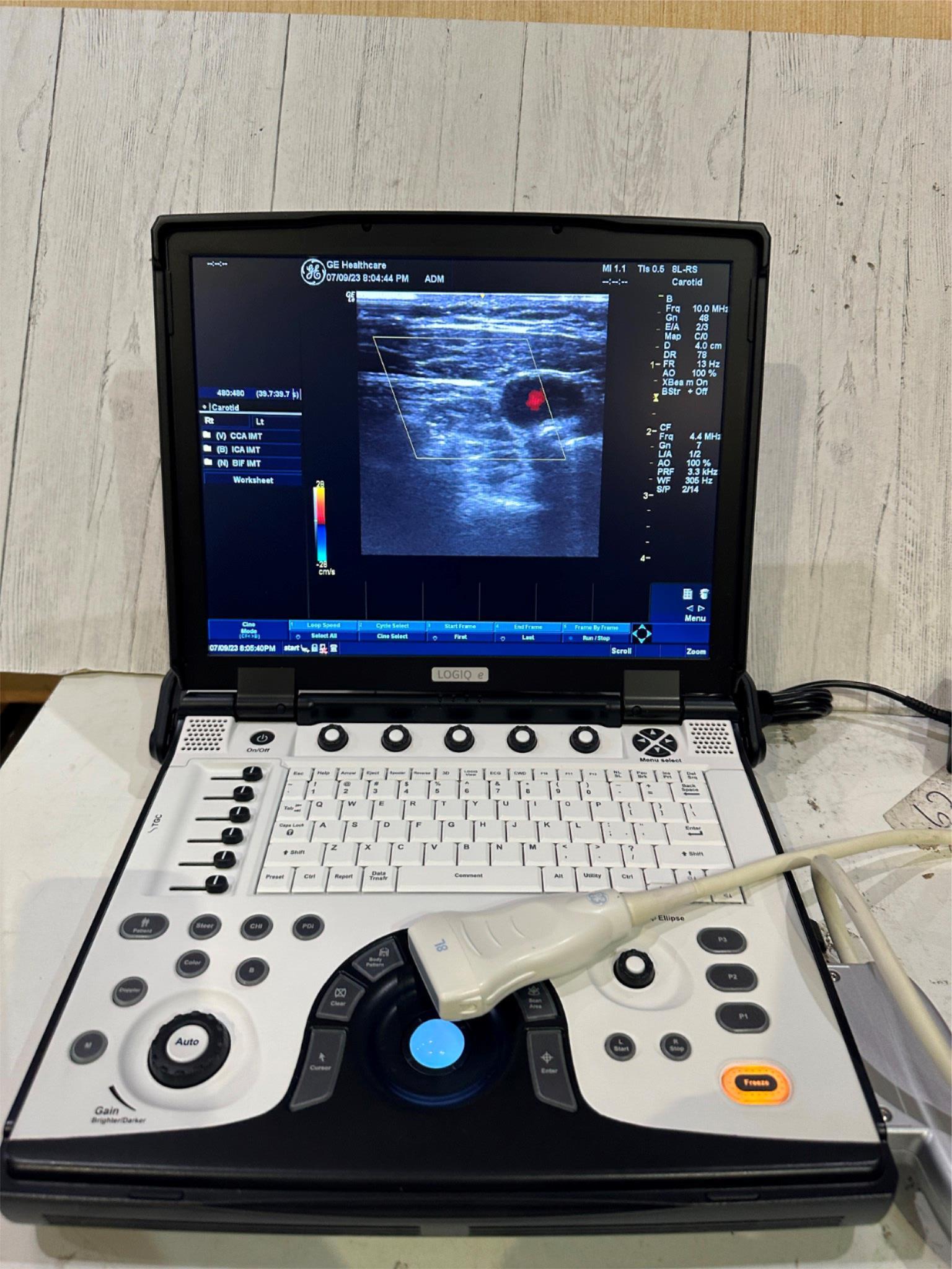 BT12 GE LOGIQ E Next Ge Ultrasound DOM 2016