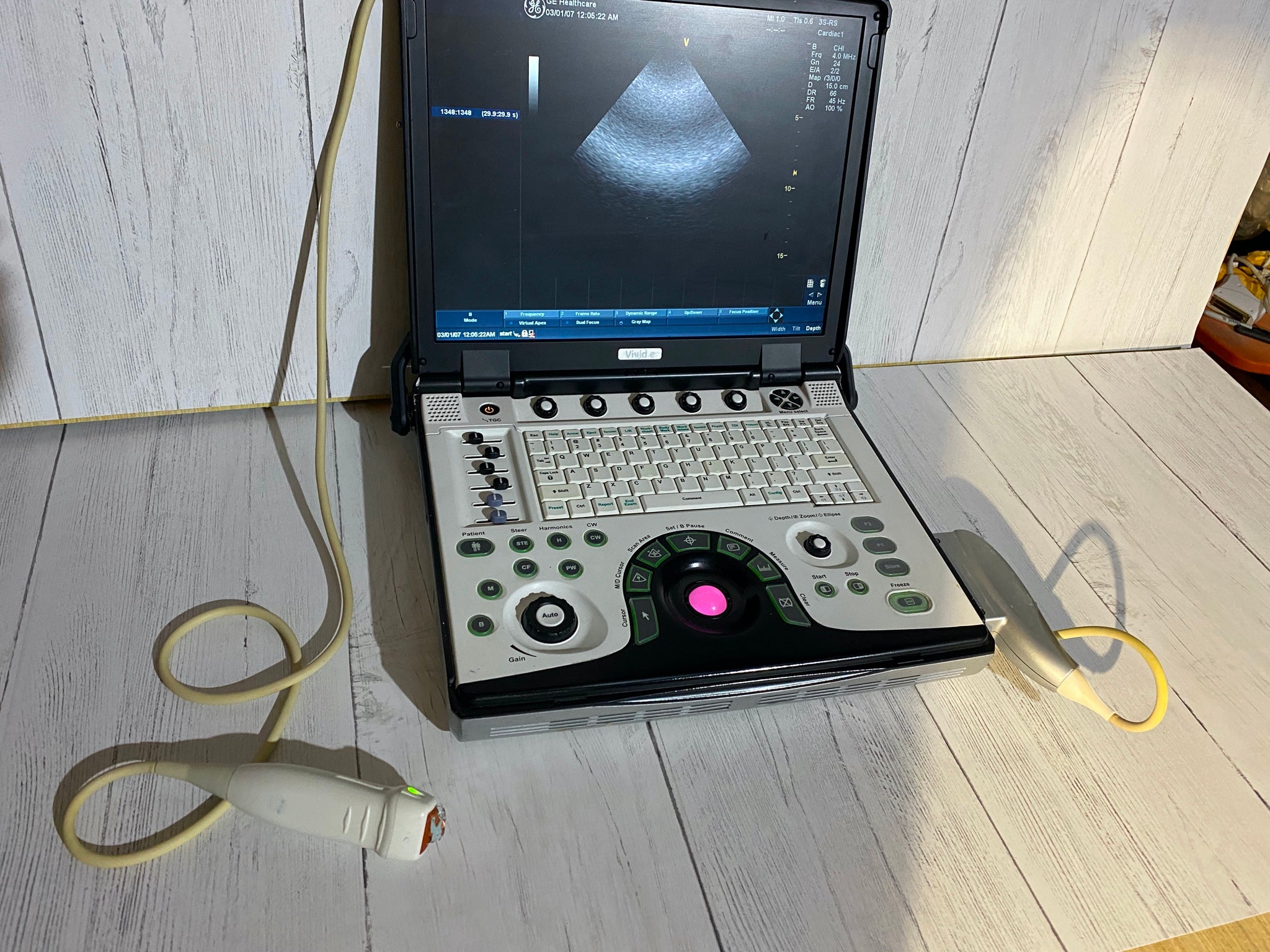 GE VIVID E Portable laptop Ultrasound with phased array probe and CW 2009 DIAGNOSTIC ULTRASOUND MACHINES FOR SALE