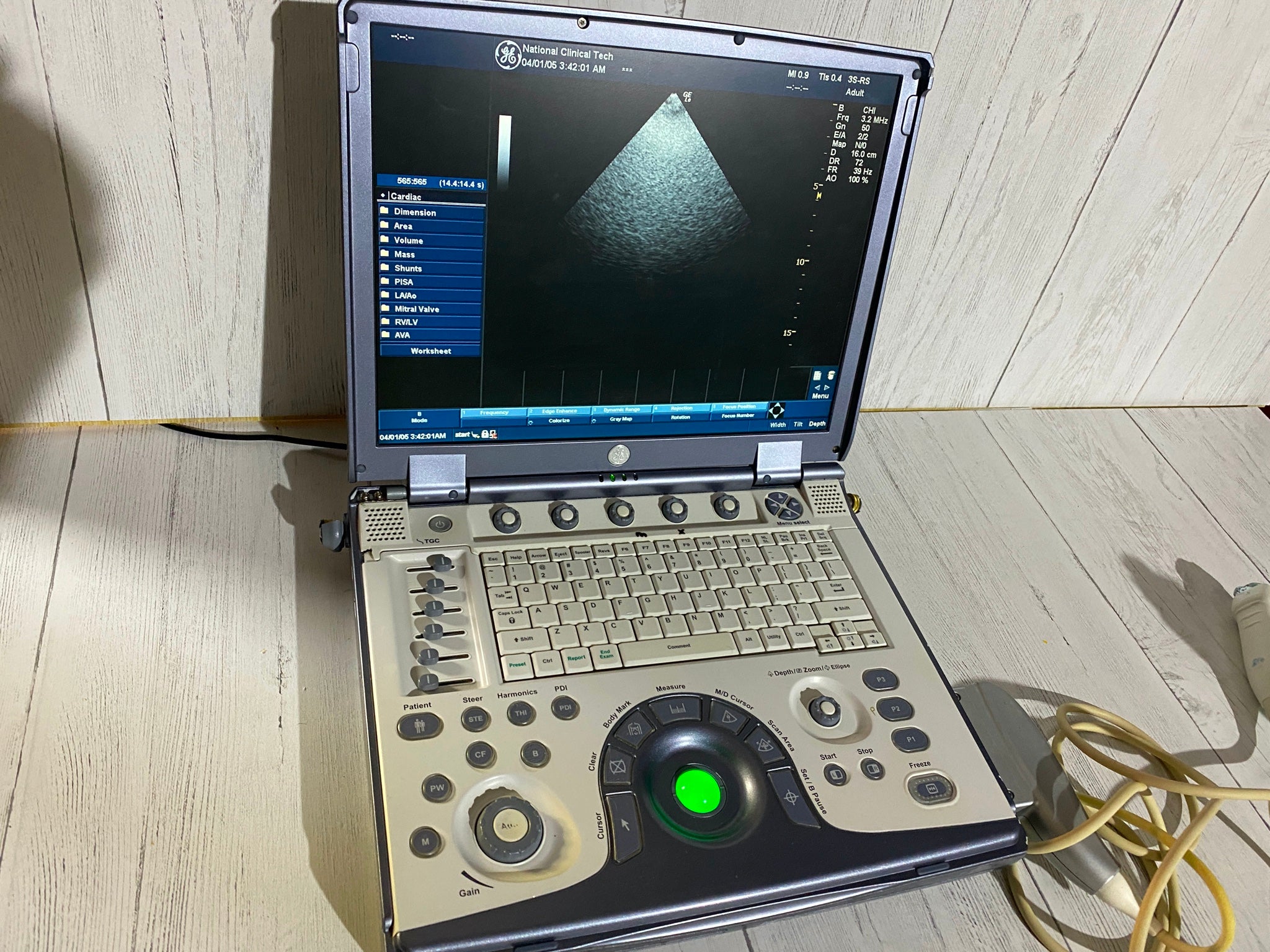 Ge Logic E portable Ultrasound machine with one linear array probe L8-8S DIAGNOSTIC ULTRASOUND MACHINES FOR SALE