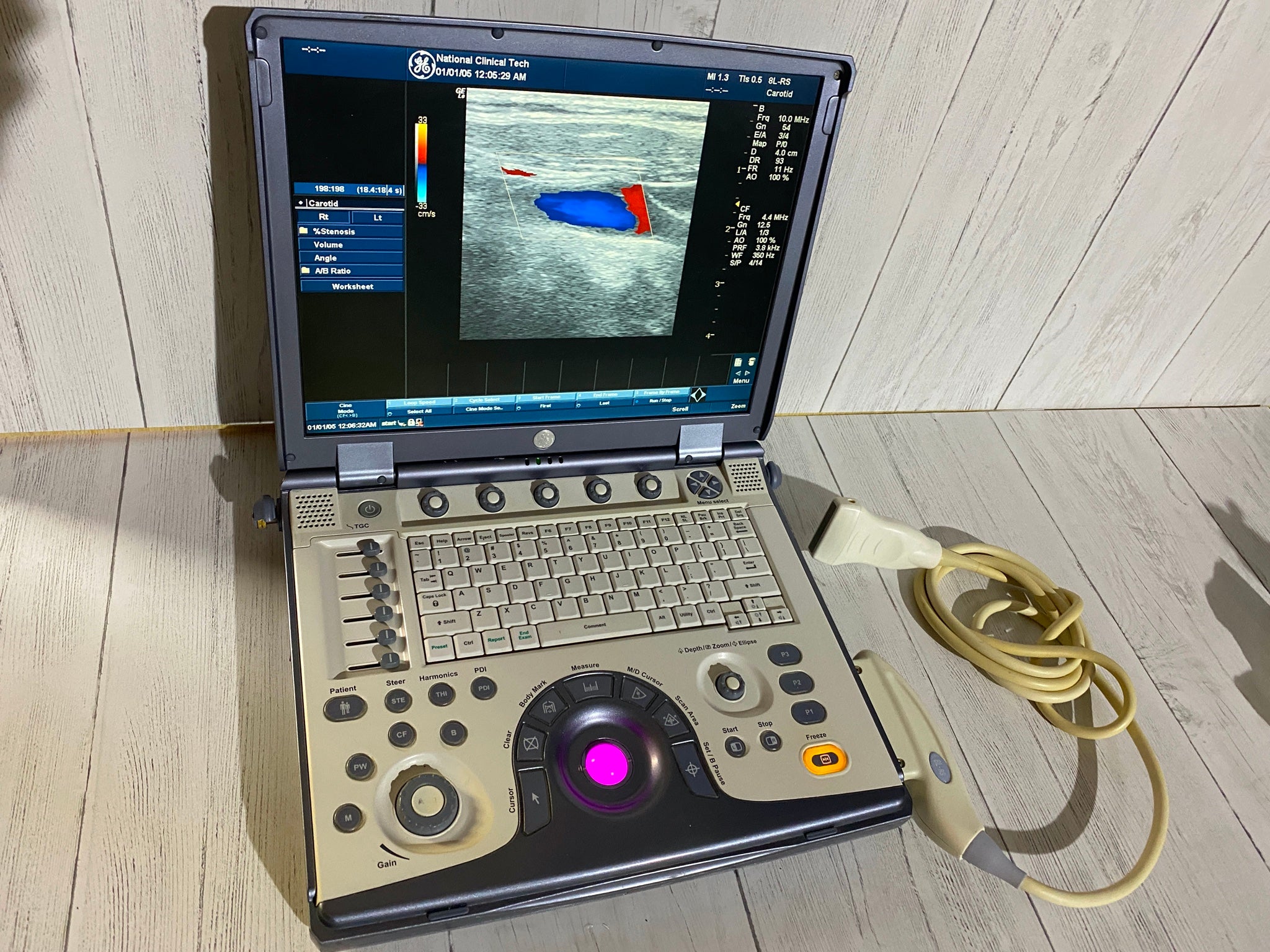 Ge Logic E portable Ultrasound machine with one linear array prone L8-8S -2006 DIAGNOSTIC ULTRASOUND MACHINES FOR SALE