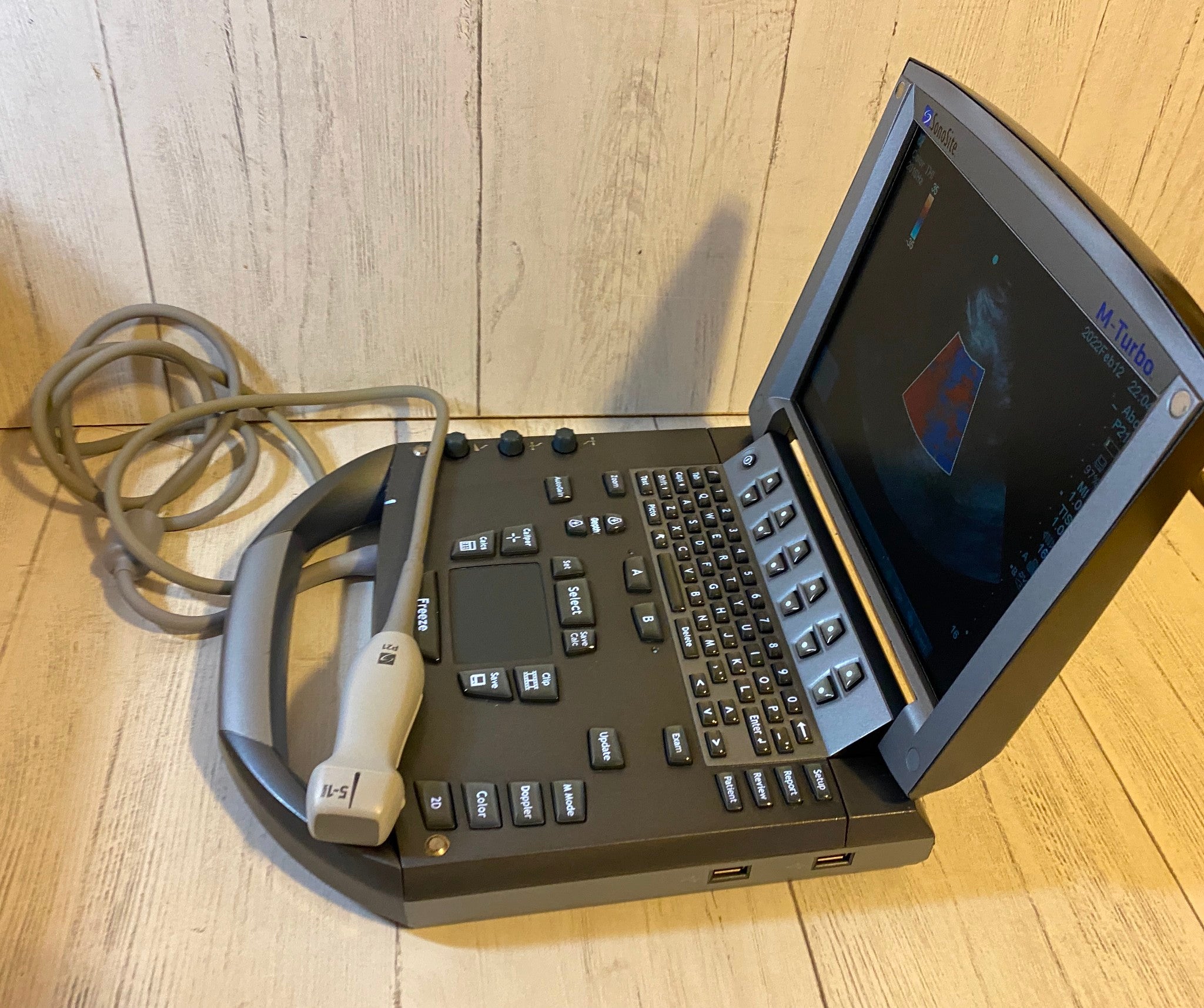 Sonosite M-Turbo Portable Ultrasound 2010 with Phased Array Probe P21 DIAGNOSTIC ULTRASOUND MACHINES FOR SALE