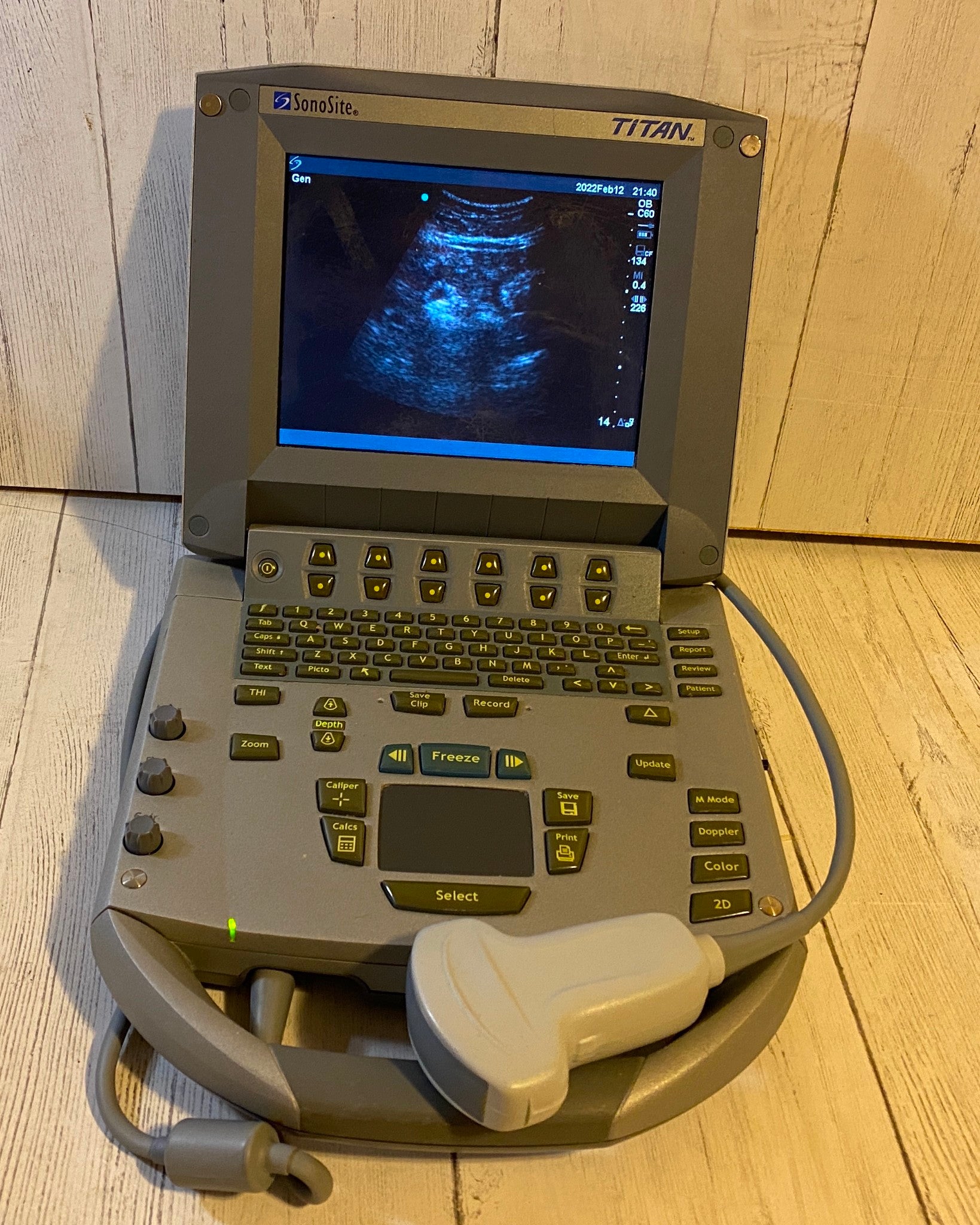 Sonosite Titan Portable Ultrasound 2005 with convex probe DIAGNOSTIC ULTRASOUND MACHINES FOR SALE