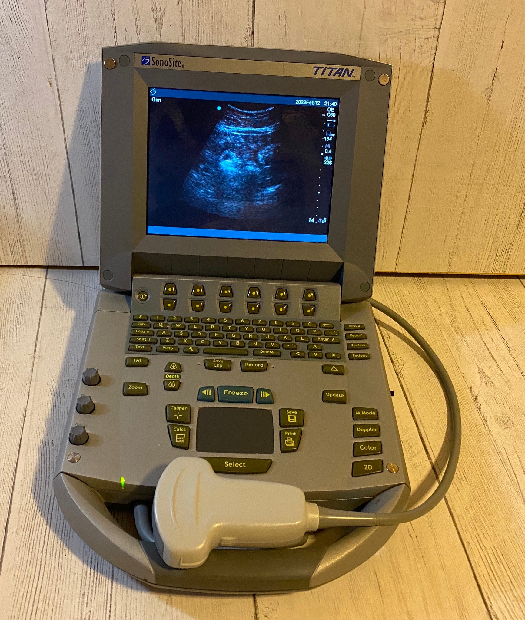 Sonosite Titan Portable Ultrasound 2005 with convex probe DIAGNOSTIC ULTRASOUND MACHINES FOR SALE
