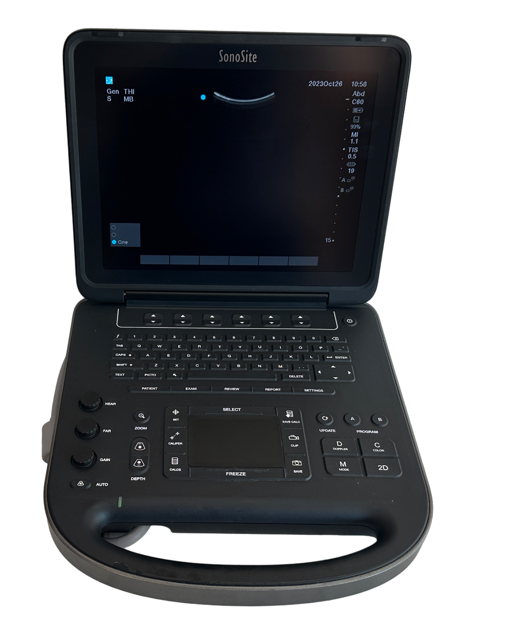 Sonosite Edge II Ultrasound 2017/Color Package DICOM, with L38xi Probe DIAGNOSTIC ULTRASOUND MACHINES FOR SALE