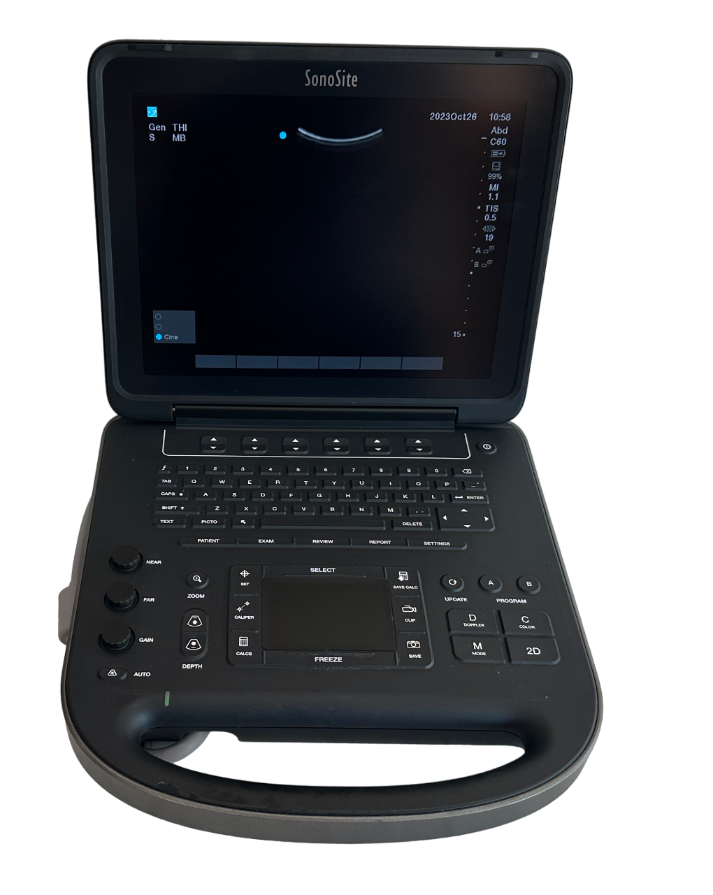 Sonosite Edge II Ultrasound 2017/Color Package DICOM, with rP19x Cardiac Probe DIAGNOSTIC ULTRASOUND MACHINES FOR SALE