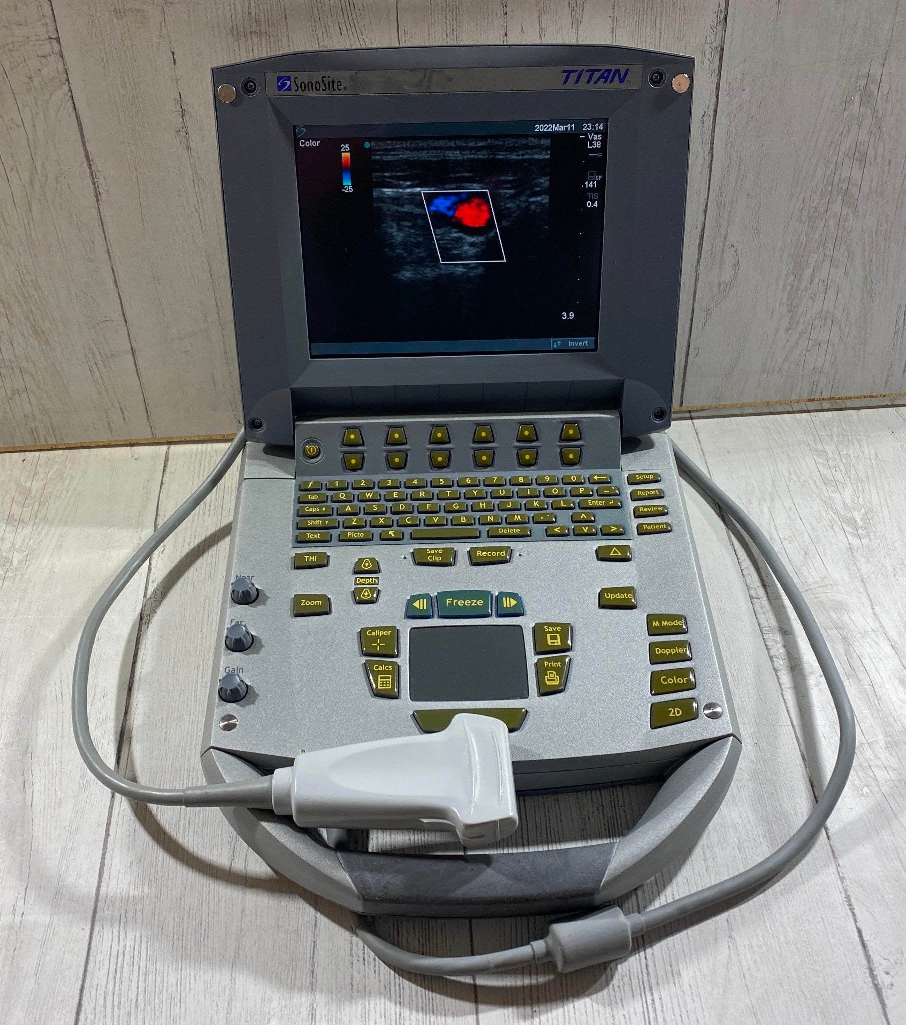 Sonosite Titan  Portable Ultrasound 2005 - With Linear Array probe L25 Probe DIAGNOSTIC ULTRASOUND MACHINES FOR SALE