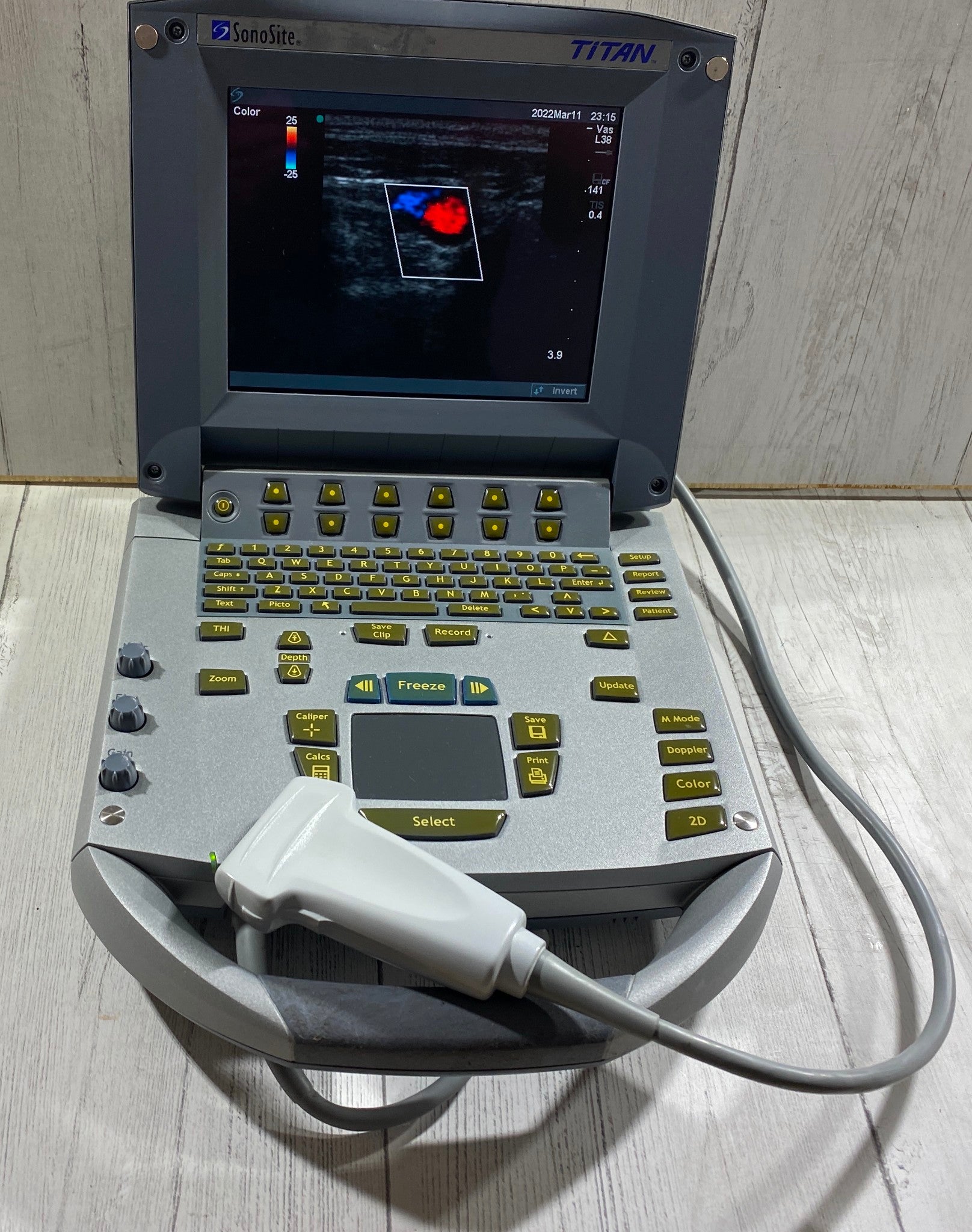 Sonosite Titan  Portable Ultrasound 2007 - With Linear Array probe L38/10-5 DIAGNOSTIC ULTRASOUND MACHINES FOR SALE