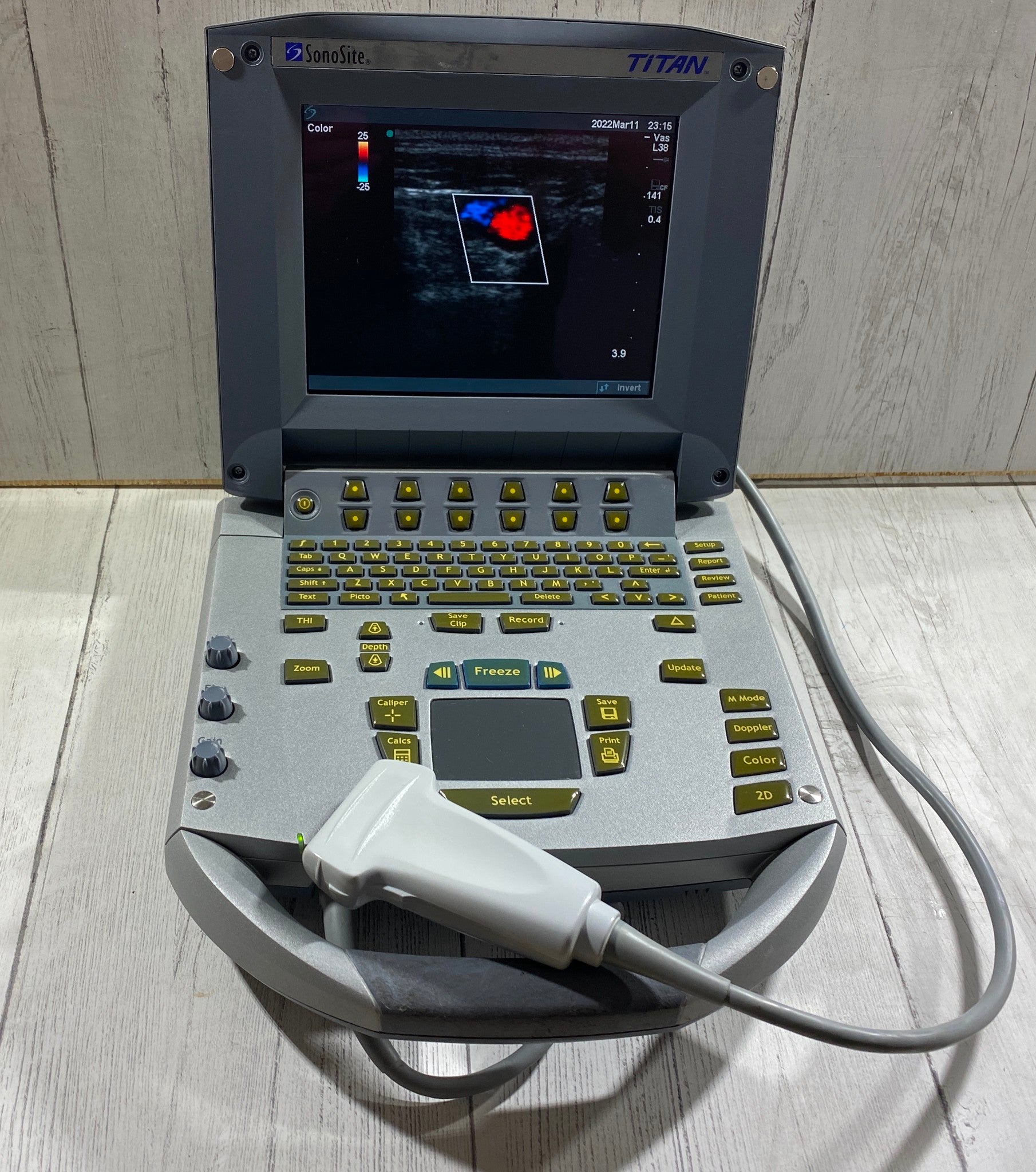 Sonosite Titan  Portable Ultrasound 2007 - With Linear Array probe L38/10-5 DIAGNOSTIC ULTRASOUND MACHINES FOR SALE