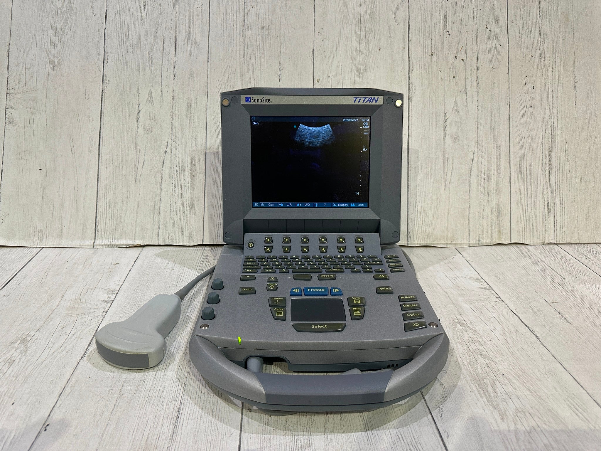 SonoSite Titan Ultrasound Machine With Convex C60 Probe Probe Warranty 6 Months DIAGNOSTIC ULTRASOUND MACHINES FOR SALE