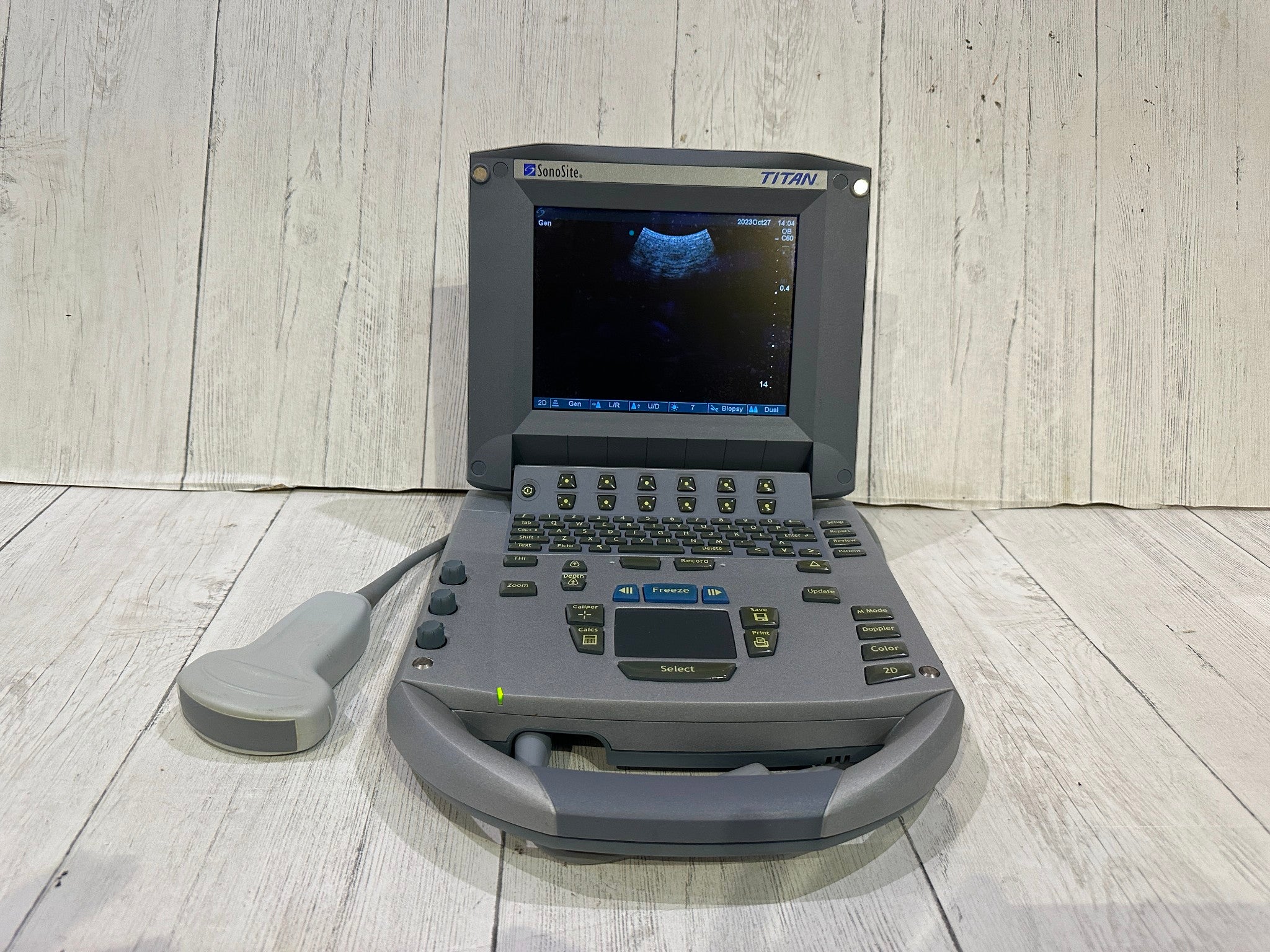 SonoSite Titan Ultrasound Machine With Convex C60 Probe Probe Warranty 6 Months DIAGNOSTIC ULTRASOUND MACHINES FOR SALE