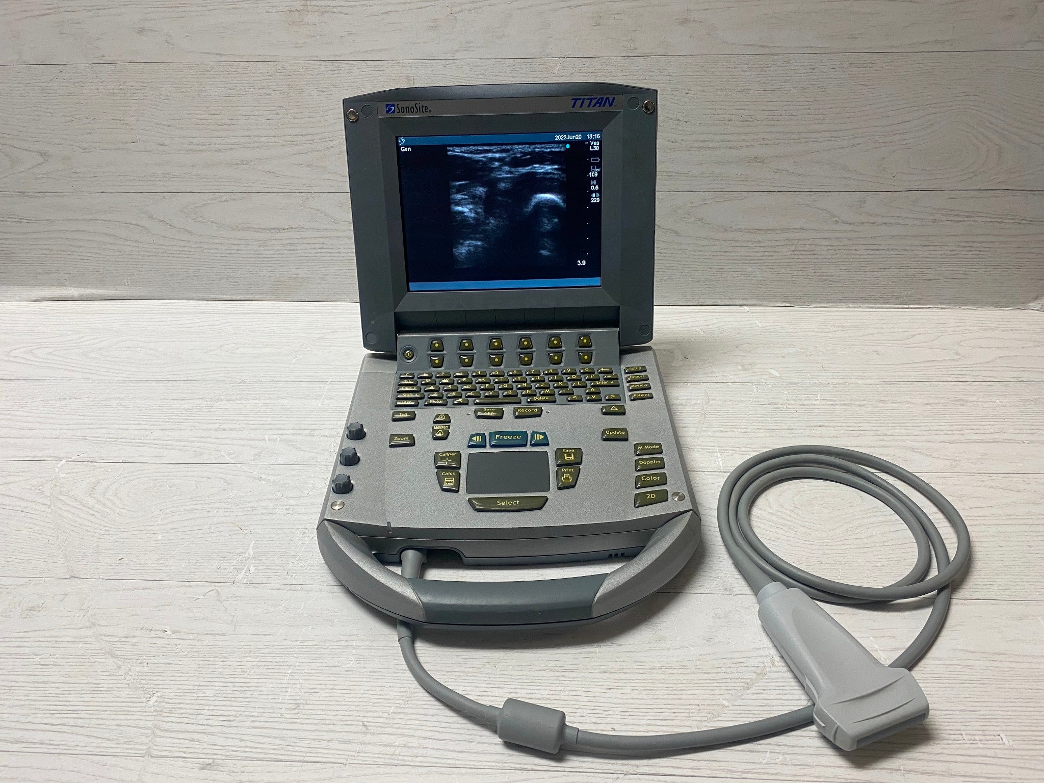 Sonosite Titan Portable Ultrasound -With Linear Array L38 and Convex C60 probes DIAGNOSTIC ULTRASOUND MACHINES FOR SALE