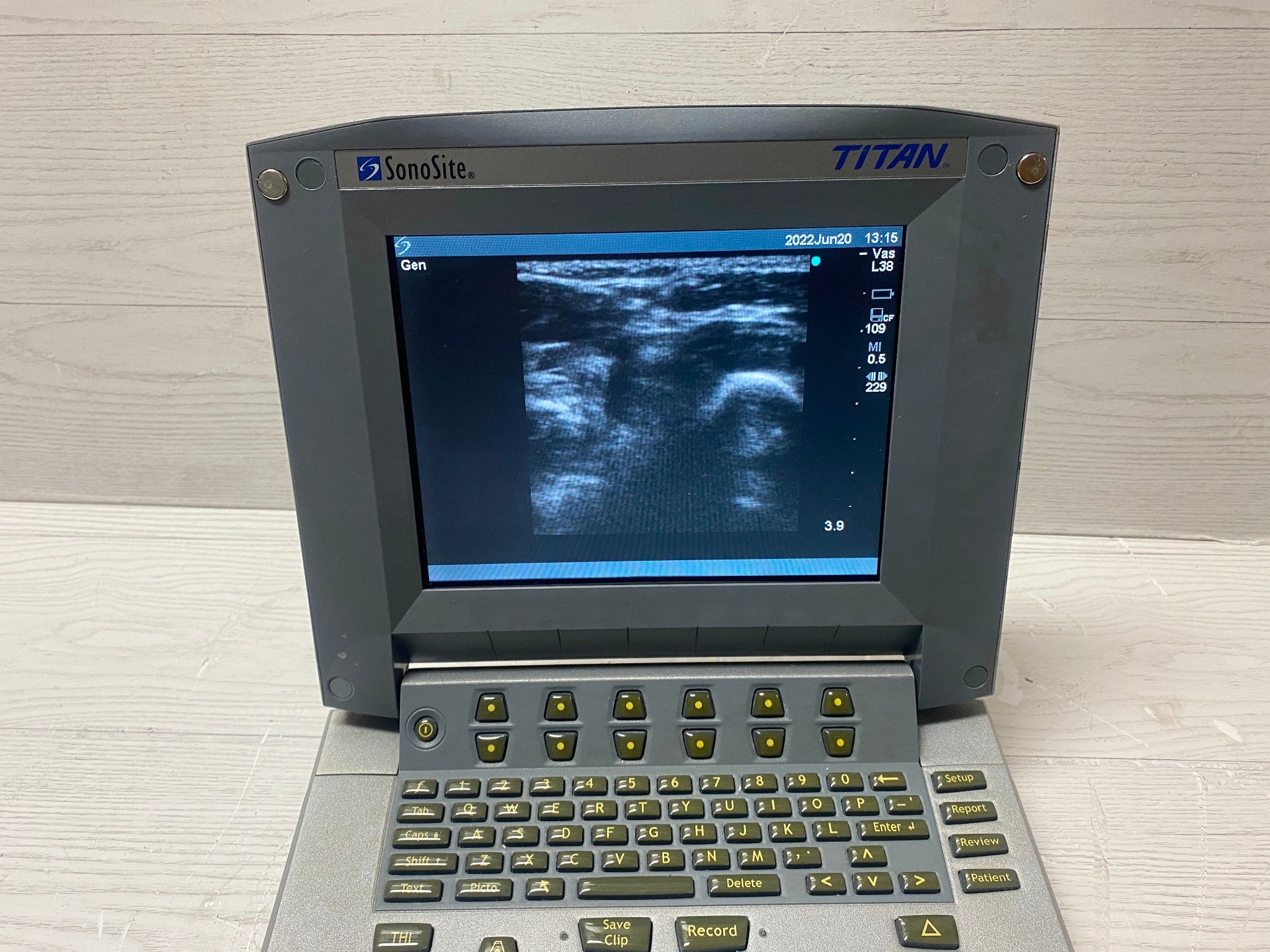 Sonosite Titan Portable Ultrasound -With Linear Array L38 and Convex C60 probes DIAGNOSTIC ULTRASOUND MACHINES FOR SALE