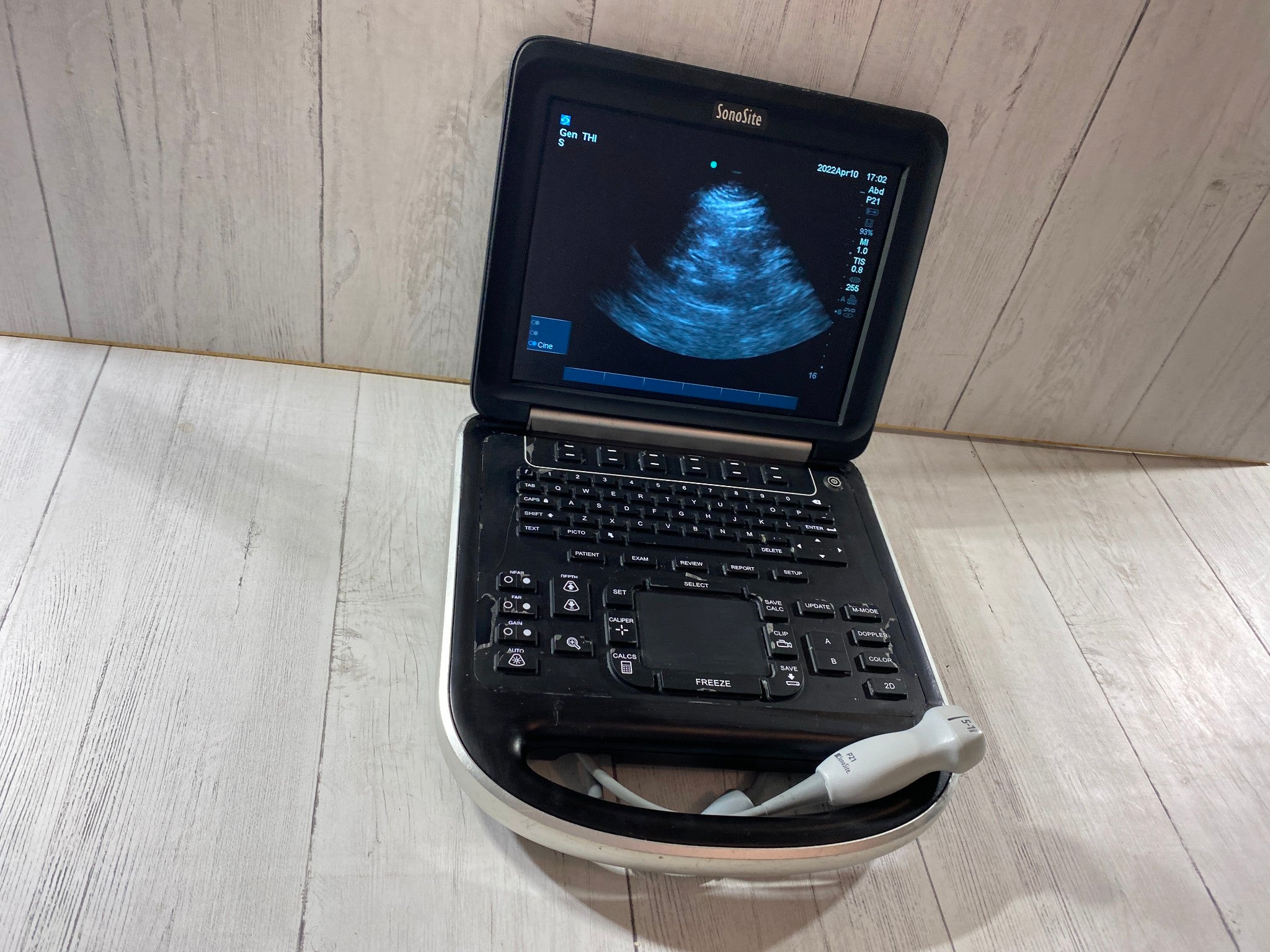 Sonosite Edge Portable ultrasound Manufactured 2013 with P21 Cardiac probe DIAGNOSTIC ULTRASOUND MACHINES FOR SALE