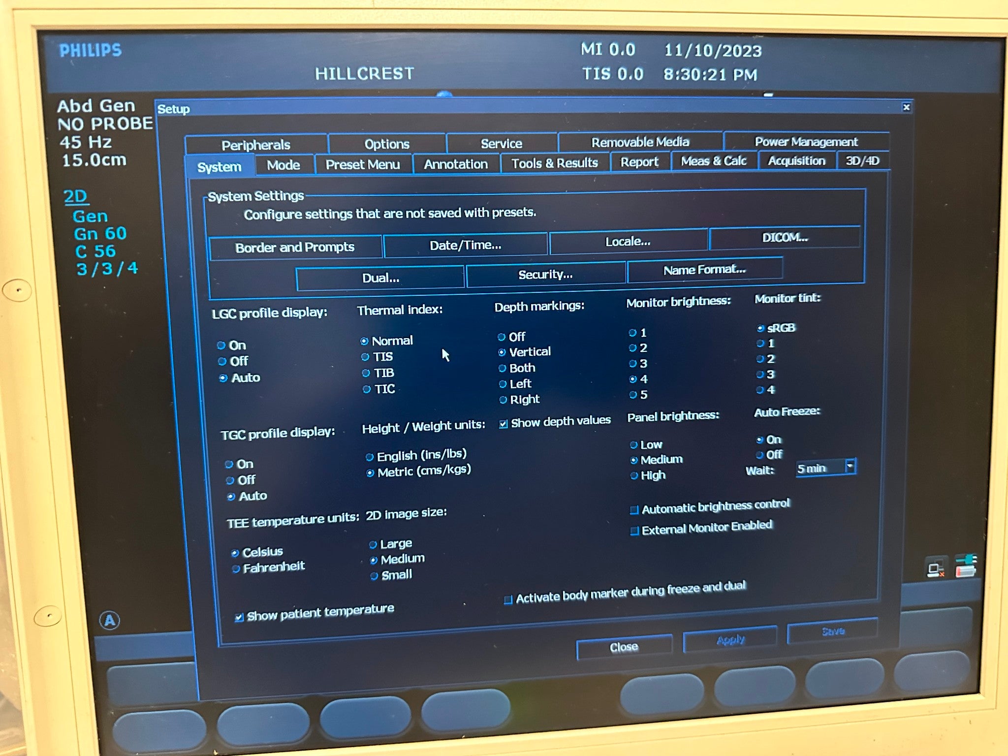 Philips CX50 Portable Ultrasound Scanner Machine 2009 Revision - 3.1.1 DIAGNOSTIC ULTRASOUND MACHINES FOR SALE