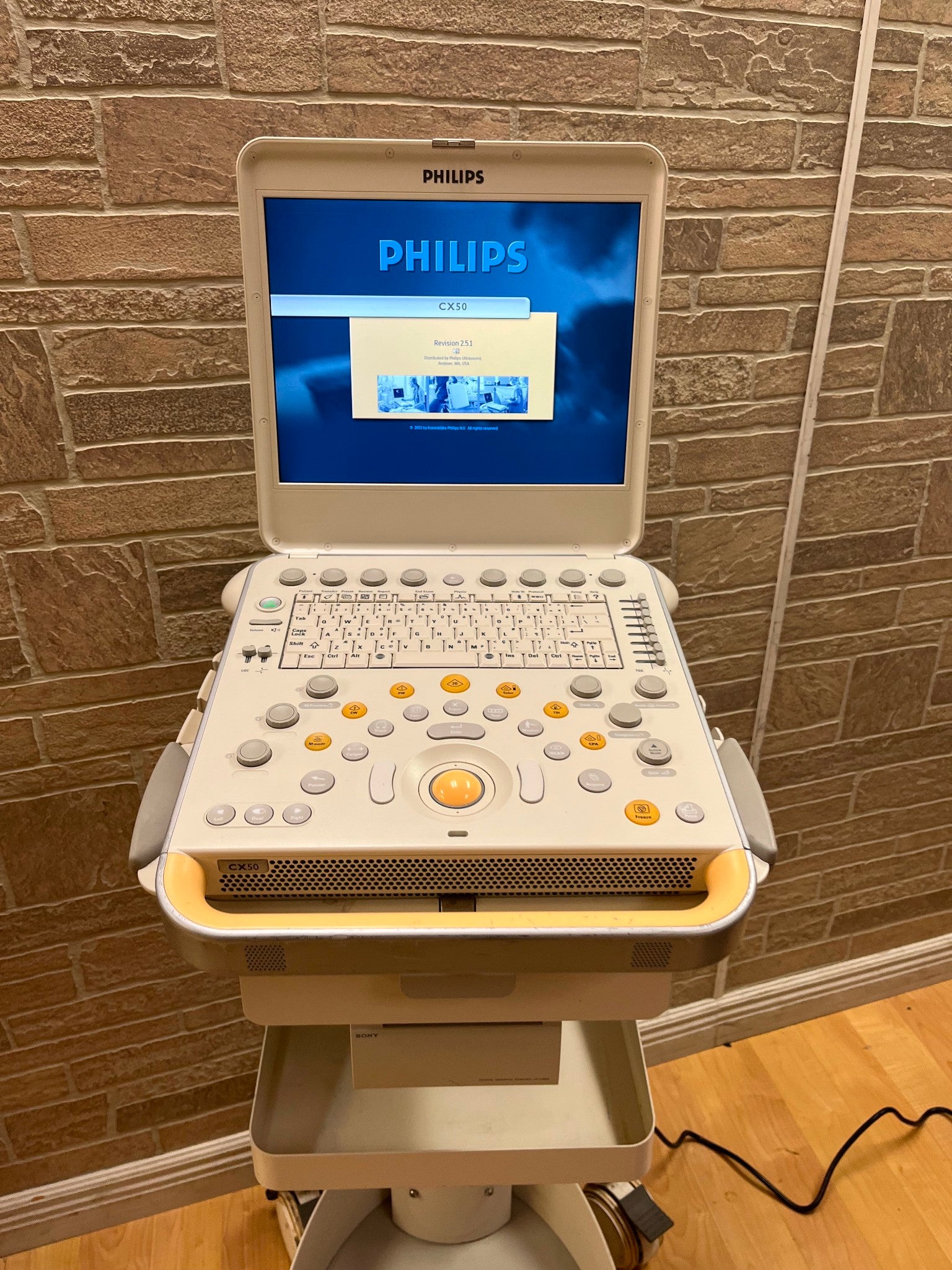 Philips CX50 Ultrasound Scanner Machine 2011 with cart DIAGNOSTIC ULTRASOUND MACHINES FOR SALE