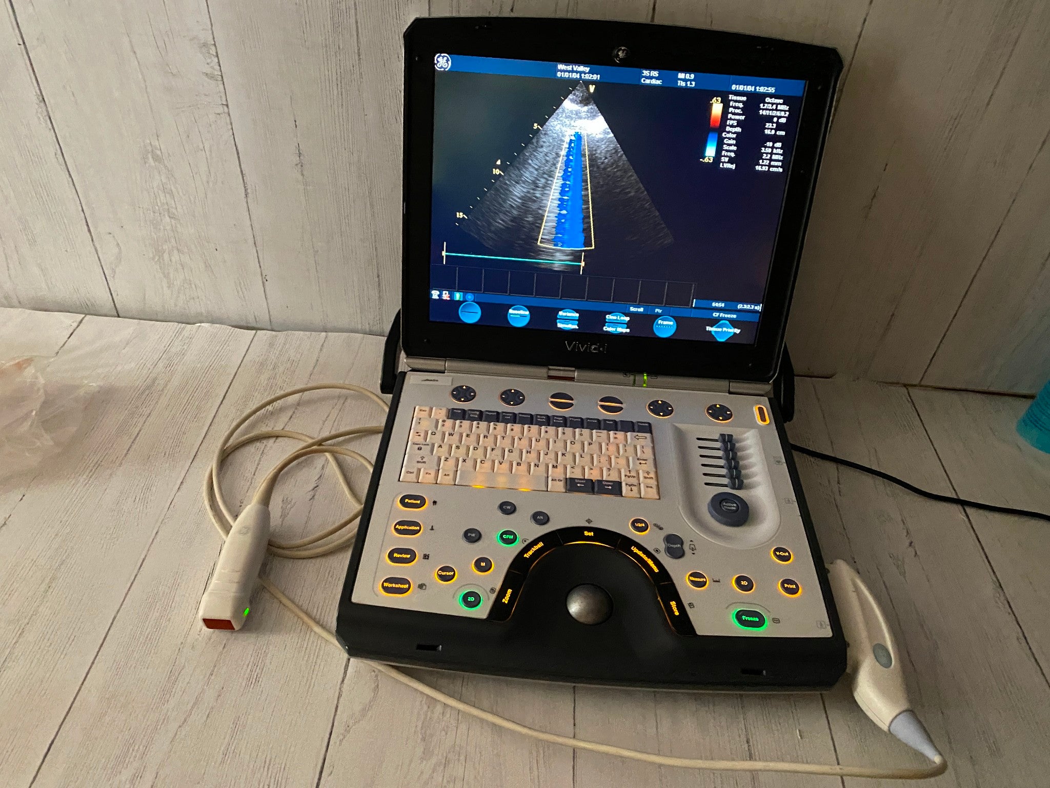 GE Vivid I  Color Doppler Ultrasound Scanner, CW  BT10 with 3s-RS cardiac probe DIAGNOSTIC ULTRASOUND MACHINES FOR SALE