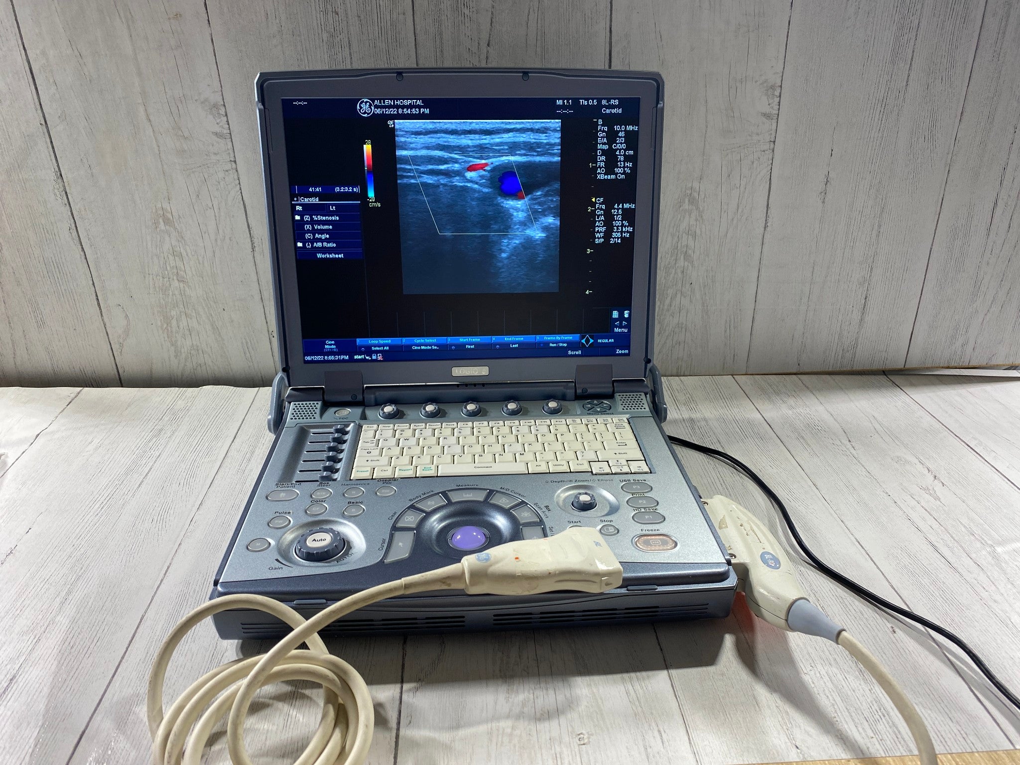 GE LogiQ E portable ultrasound with one linear array probe 8L-RS DIAGNOSTIC ULTRASOUND MACHINES FOR SALE