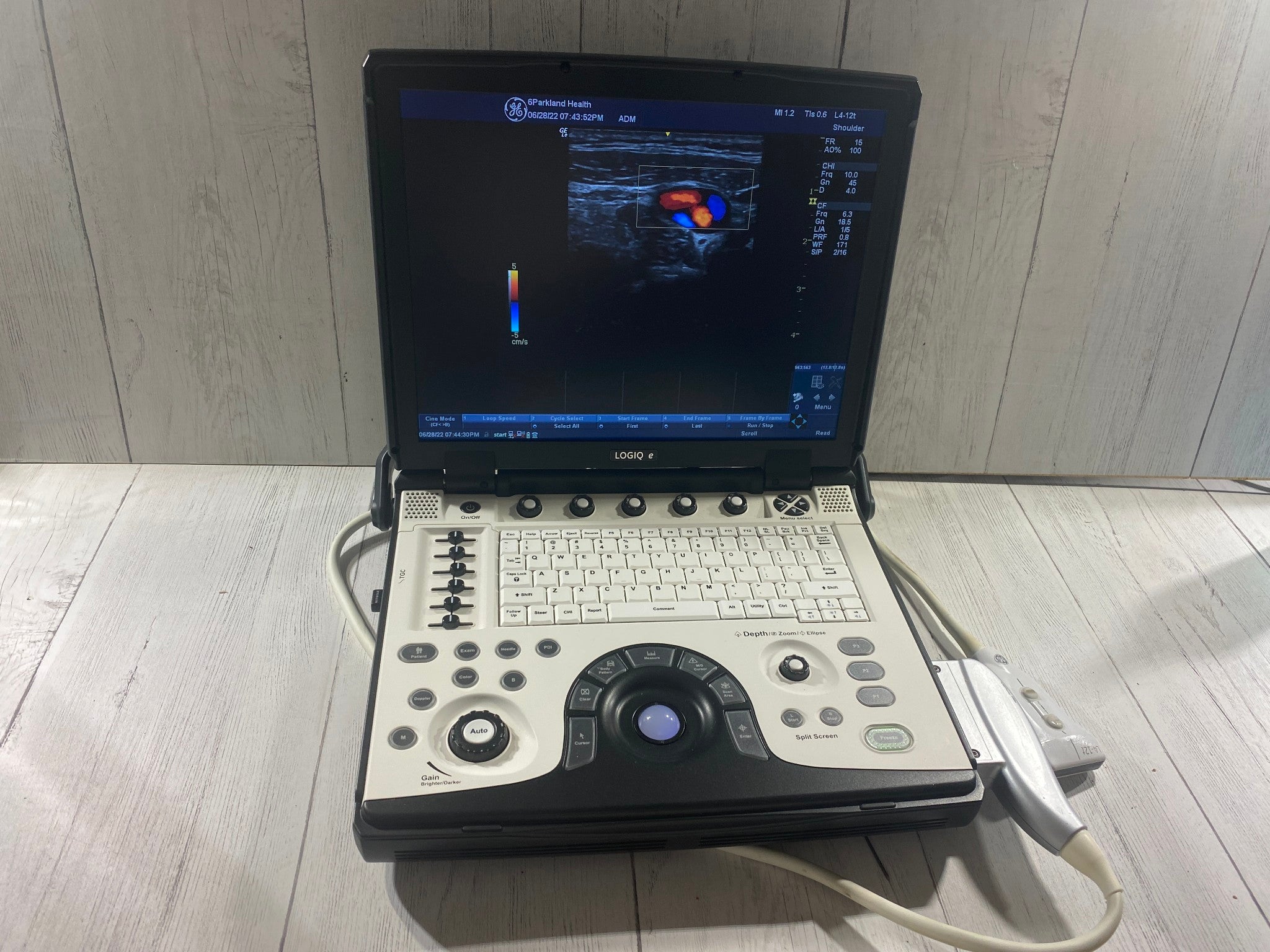 GE LOGIQ E Next Generation Ultrasound machine & Probe -L4-12T DOM 2014 R8.0.4 DIAGNOSTIC ULTRASOUND MACHINES FOR SALE