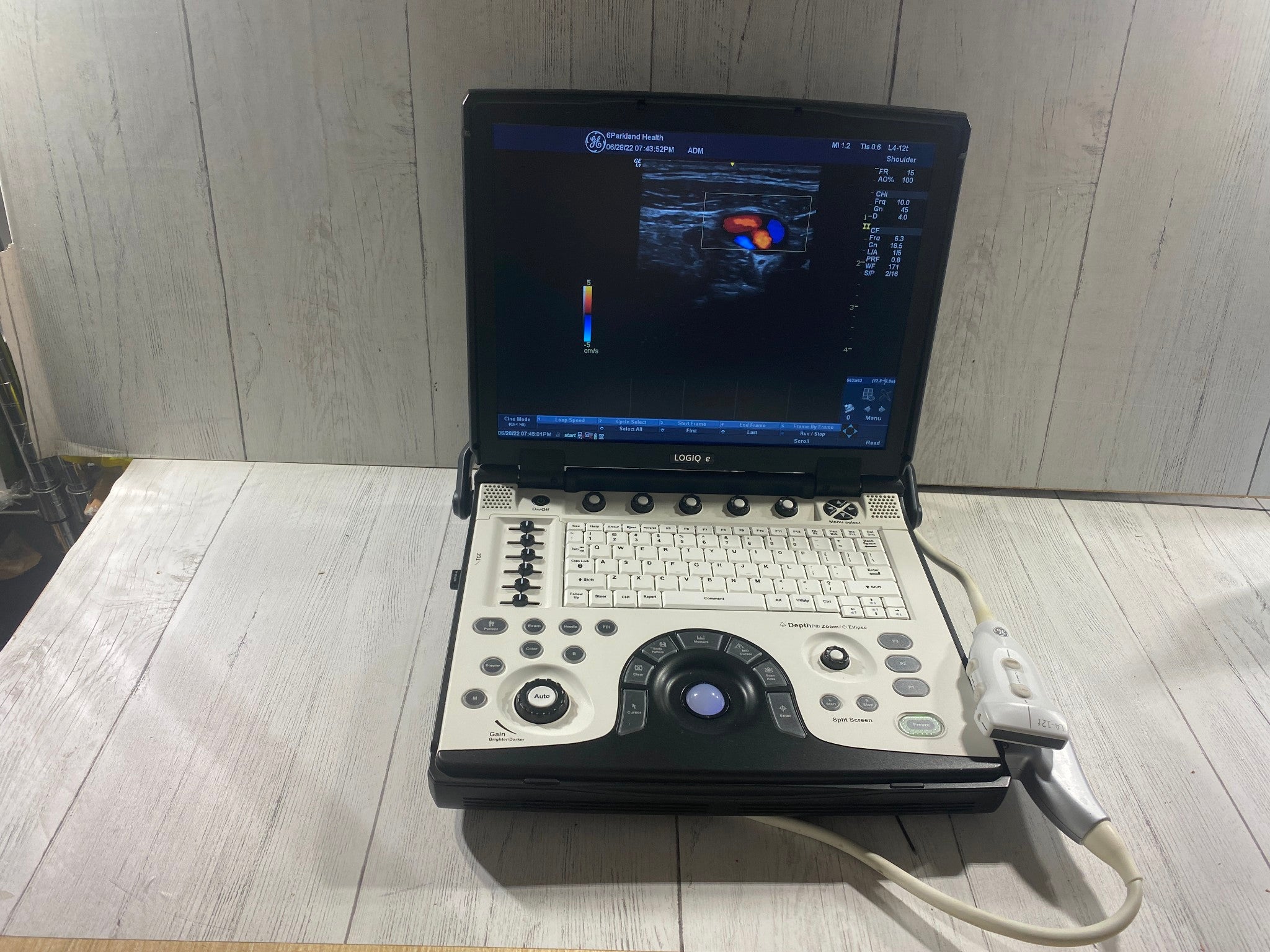 GE LOGIQ E Next Generation Ultrasound machine & Probe -L4-12T DOM 2014 R8.0.4 DIAGNOSTIC ULTRASOUND MACHINES FOR SALE