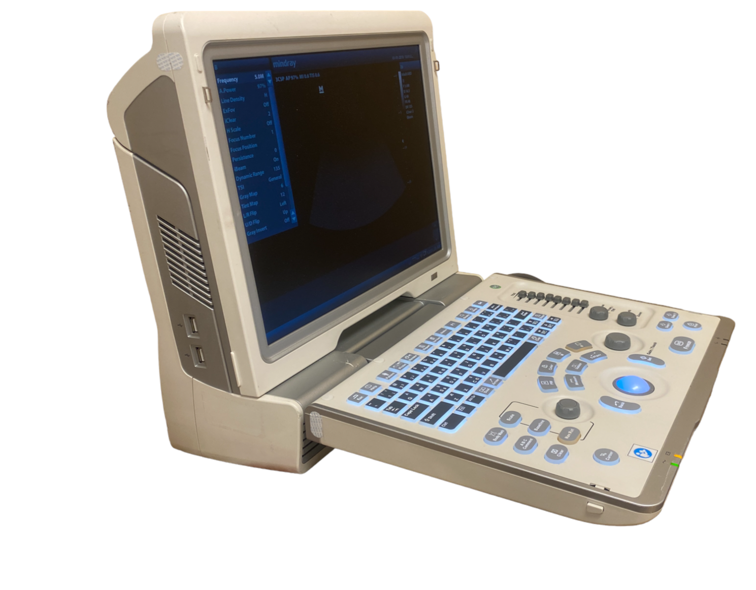 MINDRAY Z6 Ultrasound Machine with One Linear Array Probe (7L4P) 2014 DIAGNOSTIC ULTRASOUND MACHINES FOR SALE