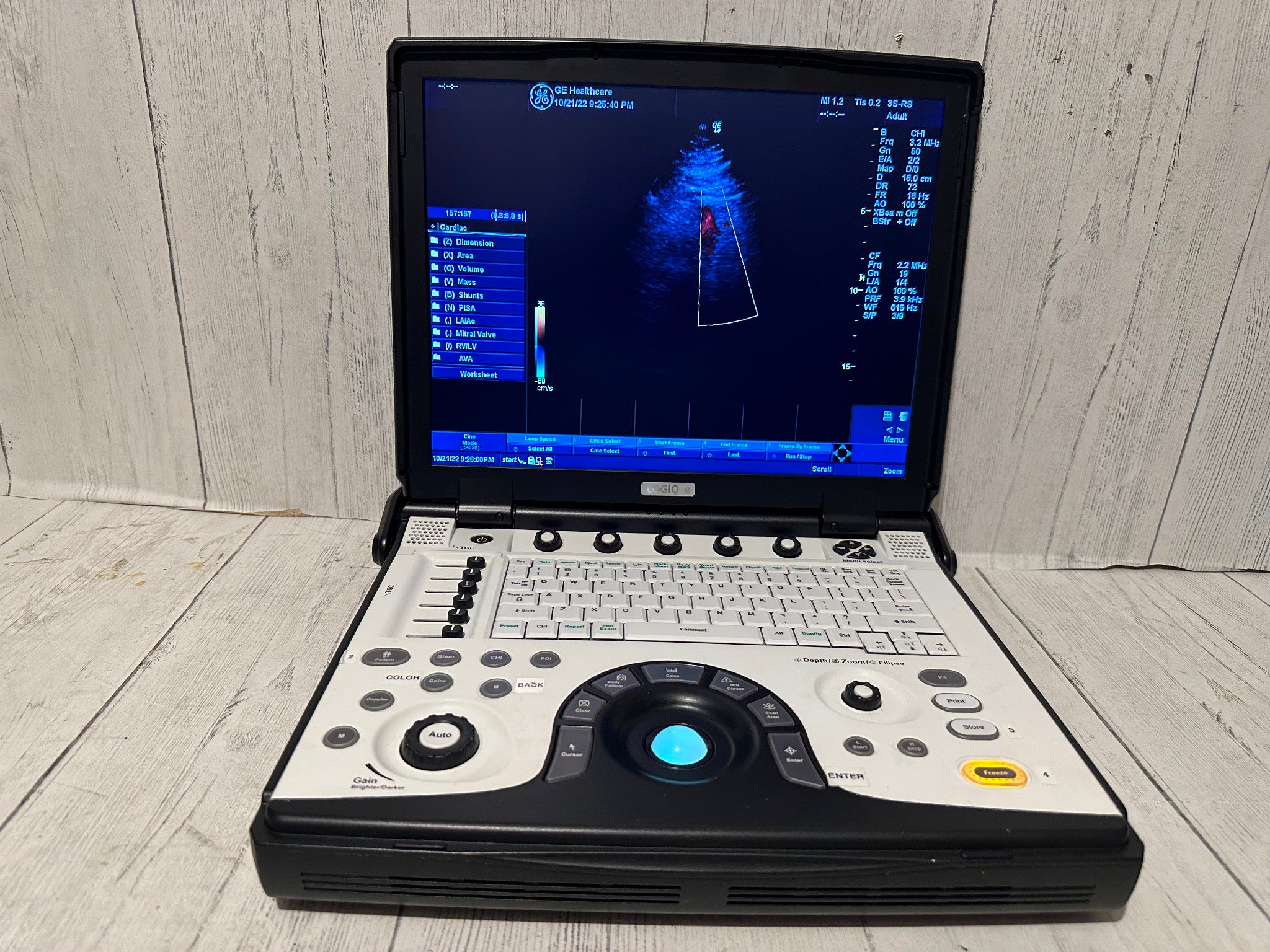 GE LOGIQ E Next Generation Ultrasound BT12  with 3S-RS Probe 2012 DIAGNOSTIC ULTRASOUND MACHINES FOR SALE