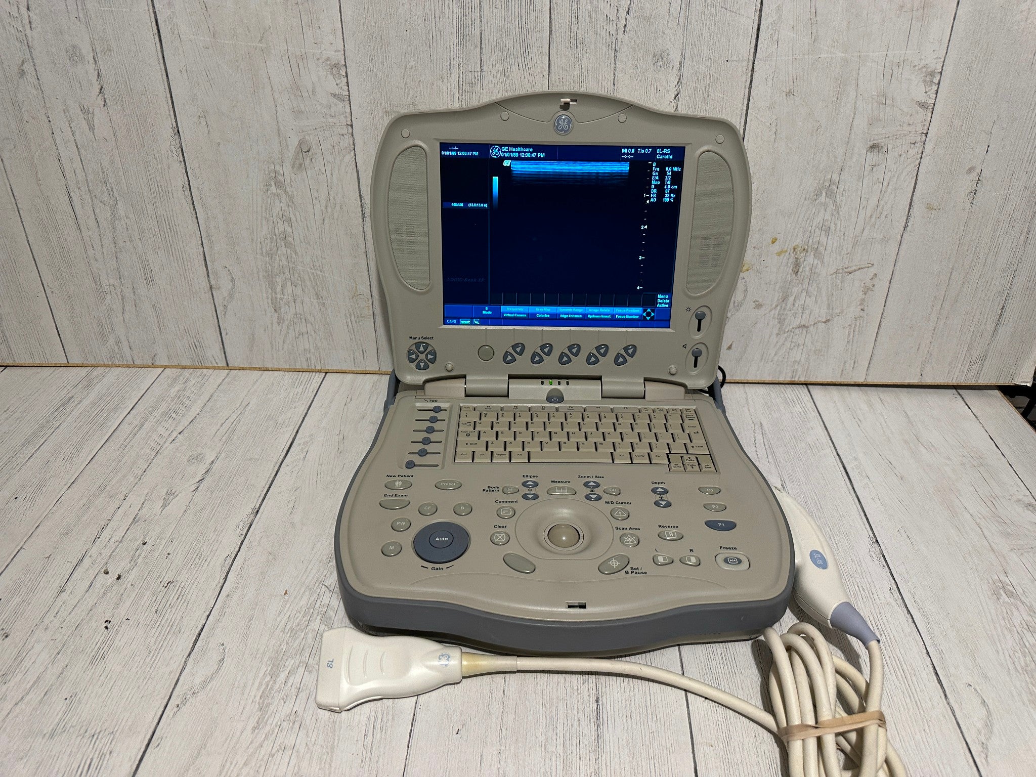 GE LOGIQ BOOK XP PORTABLE ULTRASOUND MACHINE & 3S-RS PROBE 2005 DIAGNOSTIC ULTRASOUND MACHINES FOR SALE