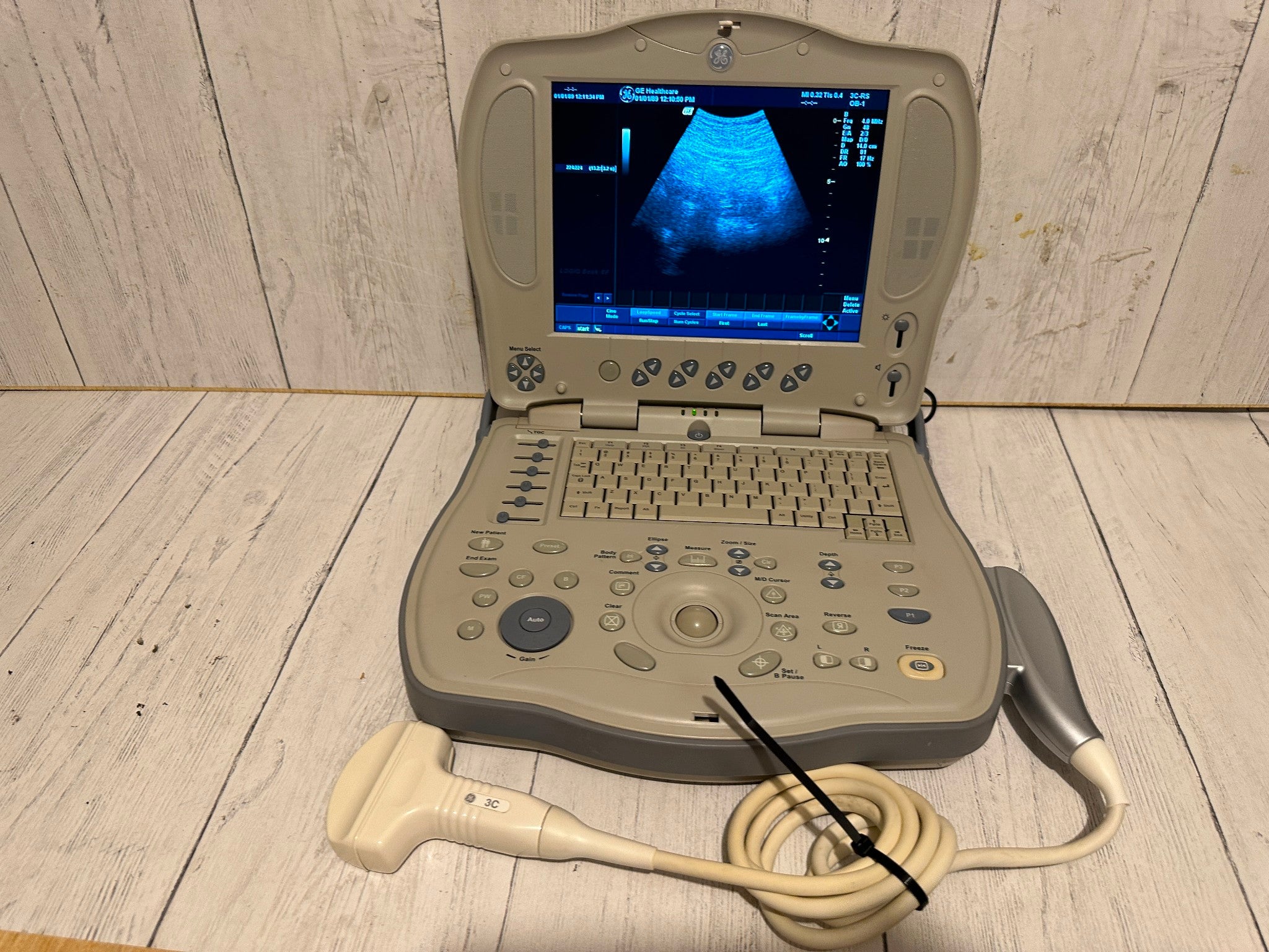 GE LOGIQ BOOK XP PORTABLE ULTRASOUND MACHINE & 3S-RS PROBE 2005 DIAGNOSTIC ULTRASOUND MACHINES FOR SALE