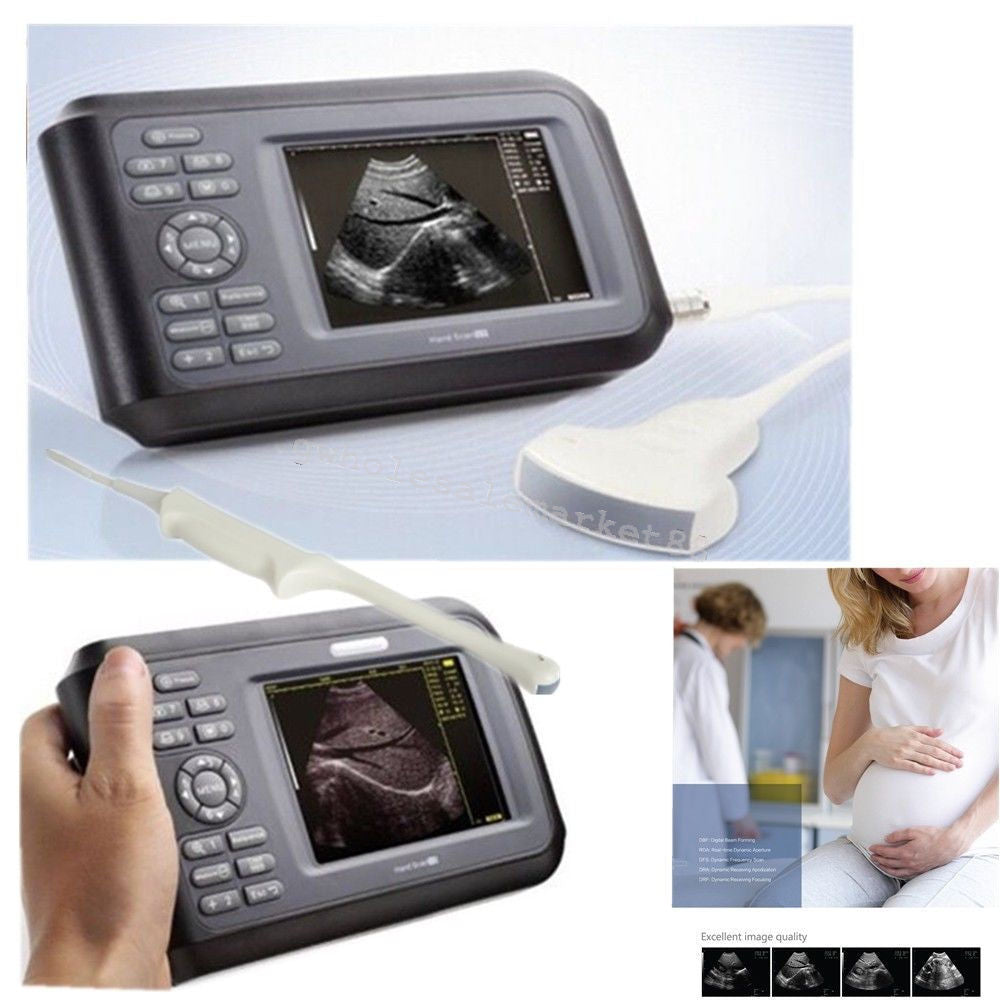 HandScan Full Digital Ultrasound scanner Machine Convex+ Transvaginal probe Case DIAGNOSTIC ULTRASOUND MACHINES FOR SALE