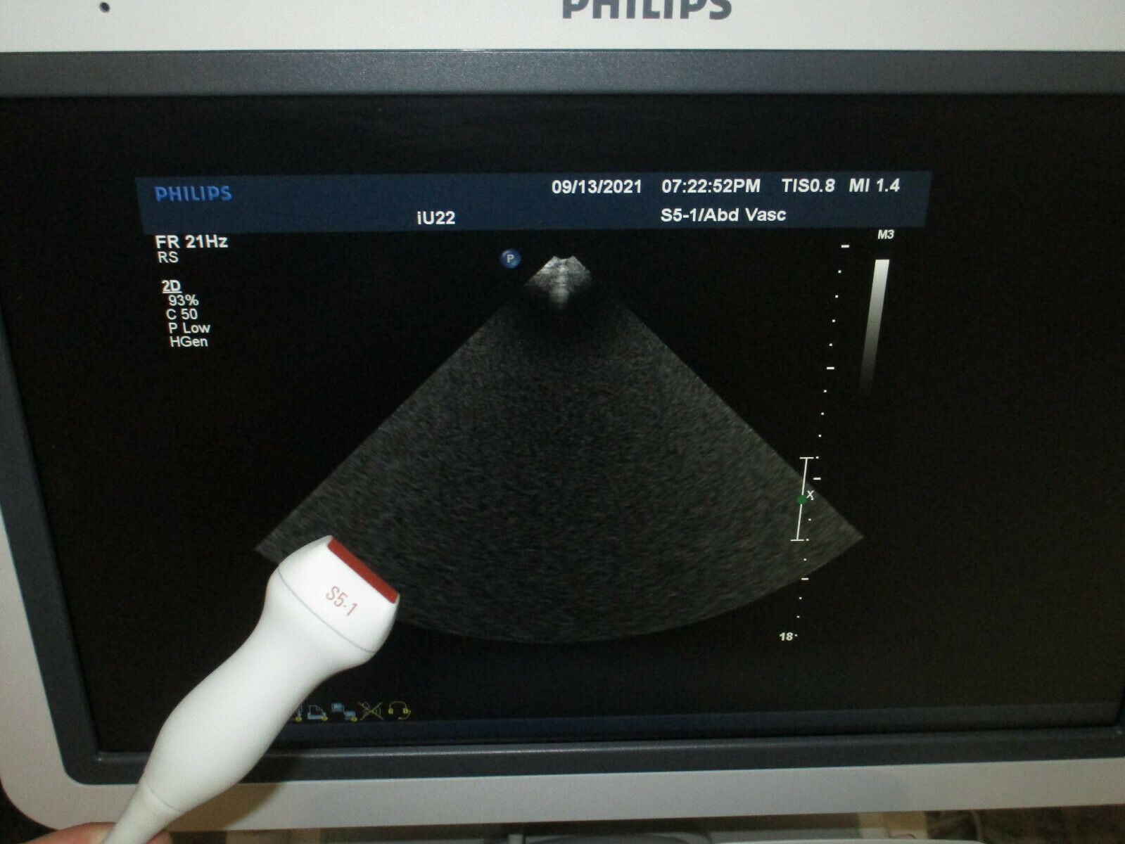 Philips S5-1 Sector Array Ultrasound Transducer Probe DIAGNOSTIC ULTRASOUND MACHINES FOR SALE