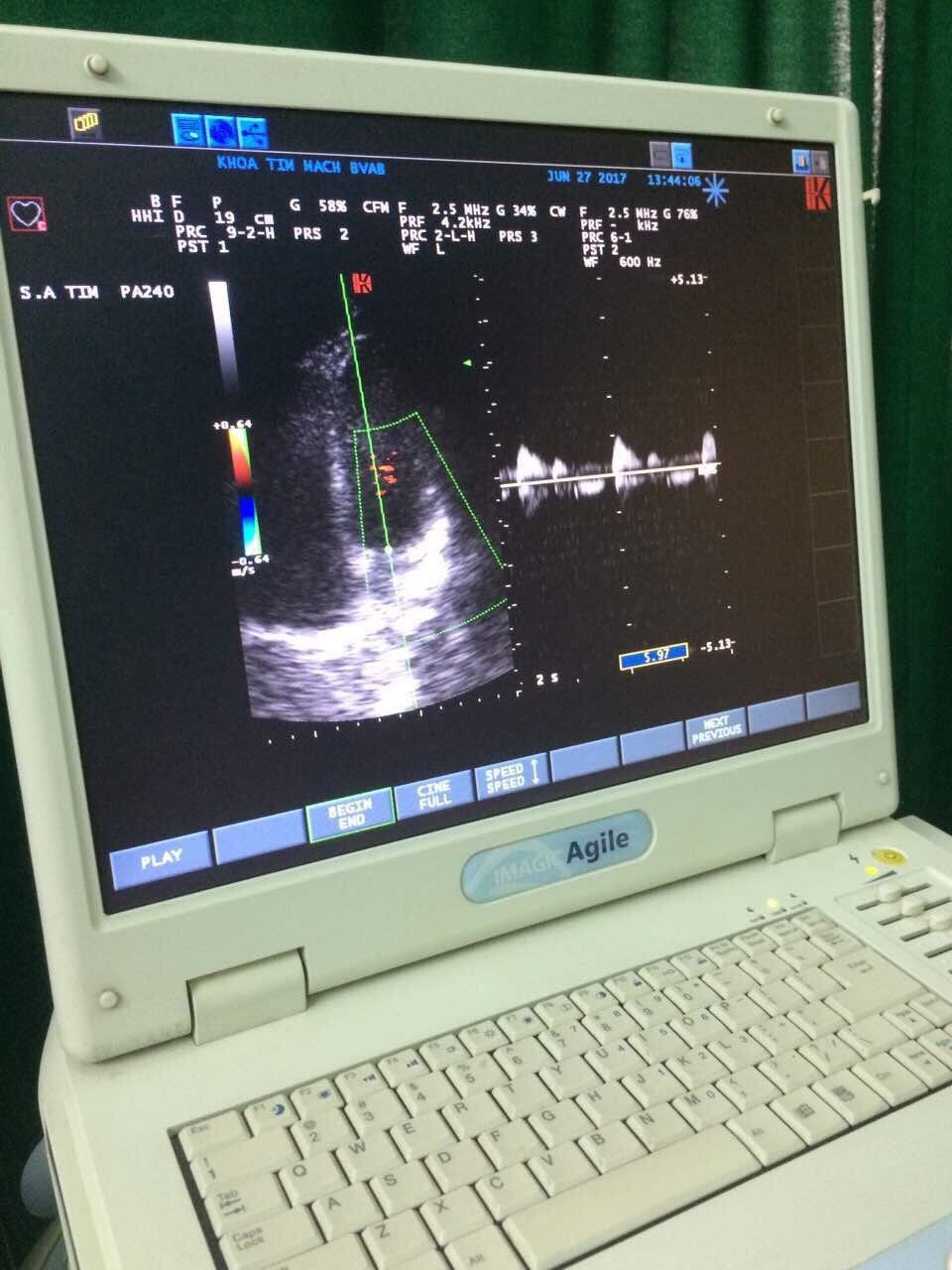 Esaote Biosound Megas/ MyLab ultrasound PA240 Phase Array probe DIAGNOSTIC ULTRASOUND MACHINES FOR SALE